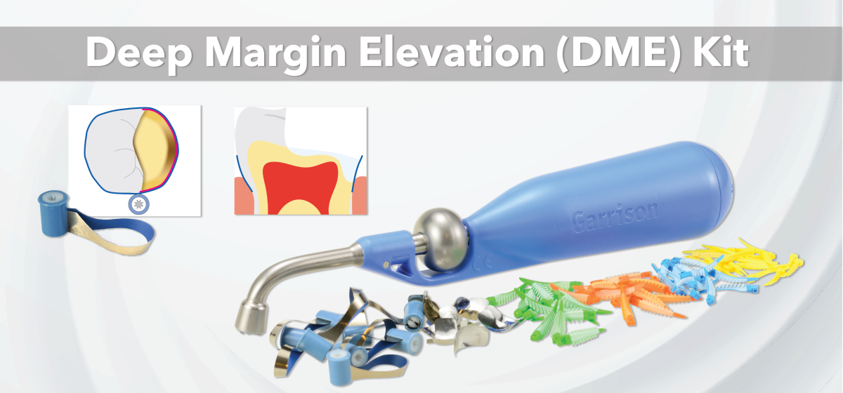 Deep margin elevation (DME) kit slide updated