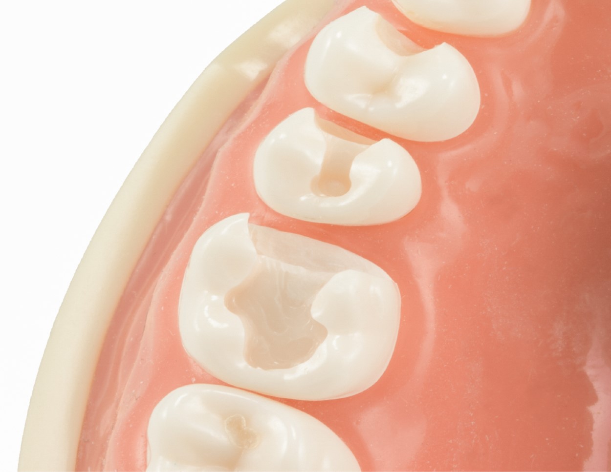 Matrix Comparison Guide Garrison Dental