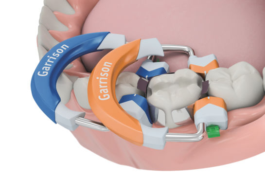 Garrison Dental | Composi-Tight® 3D Fusion™