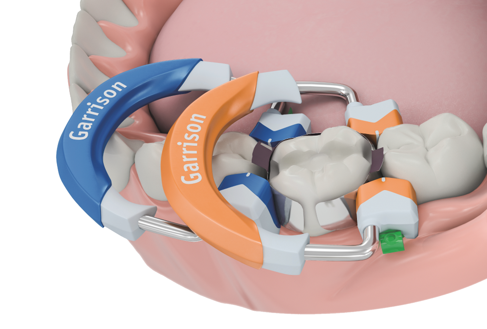 Garrison Dental 3D Fusion diagram