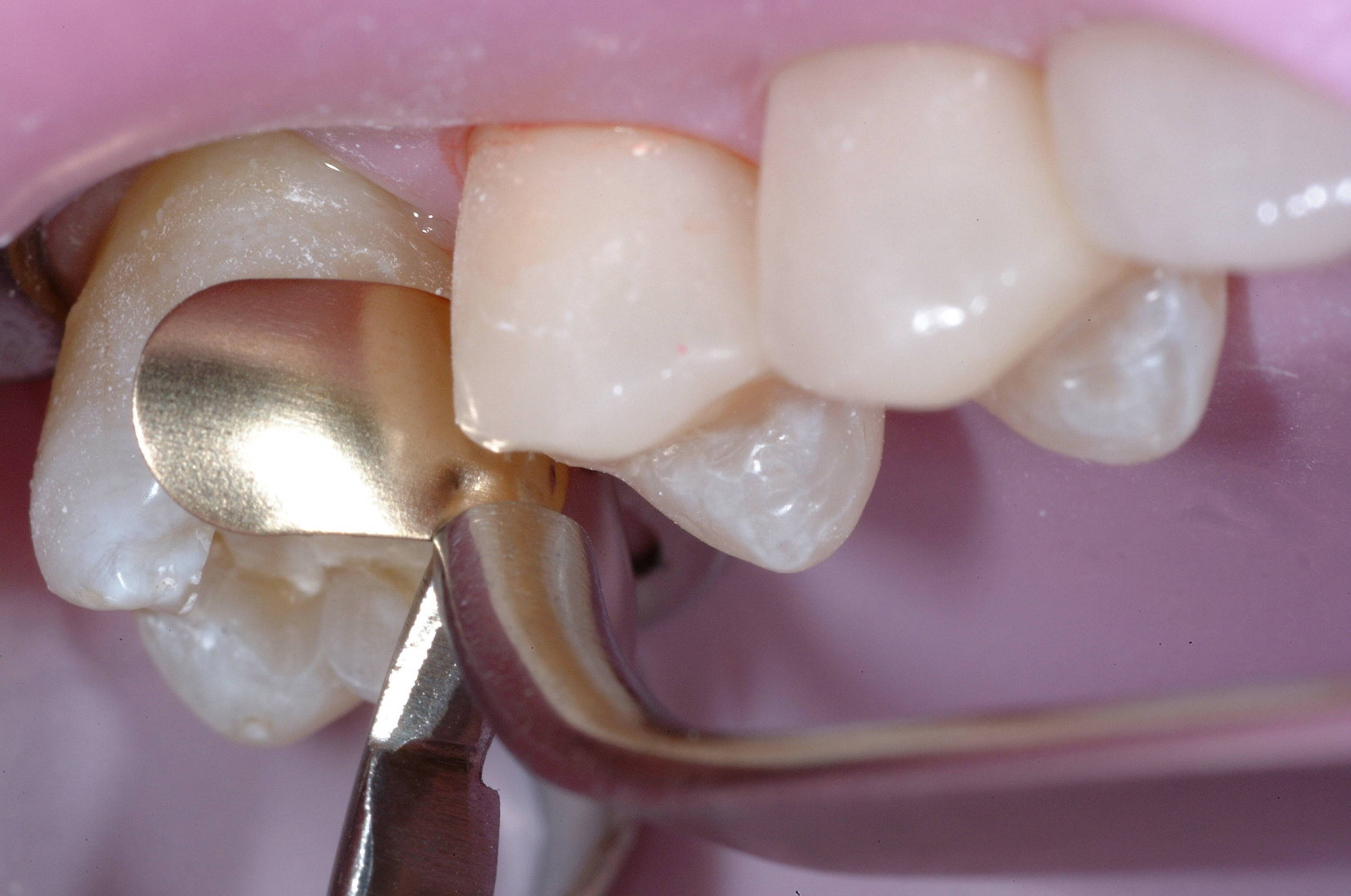 garrison dental garrison dental
