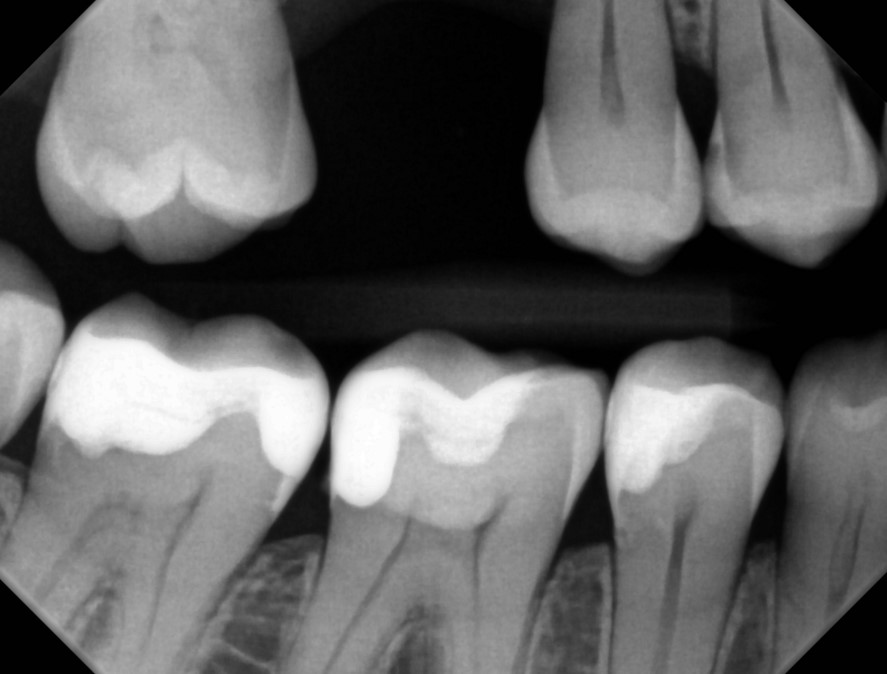 Figure 12