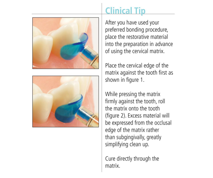 Cervical Clinical Tip