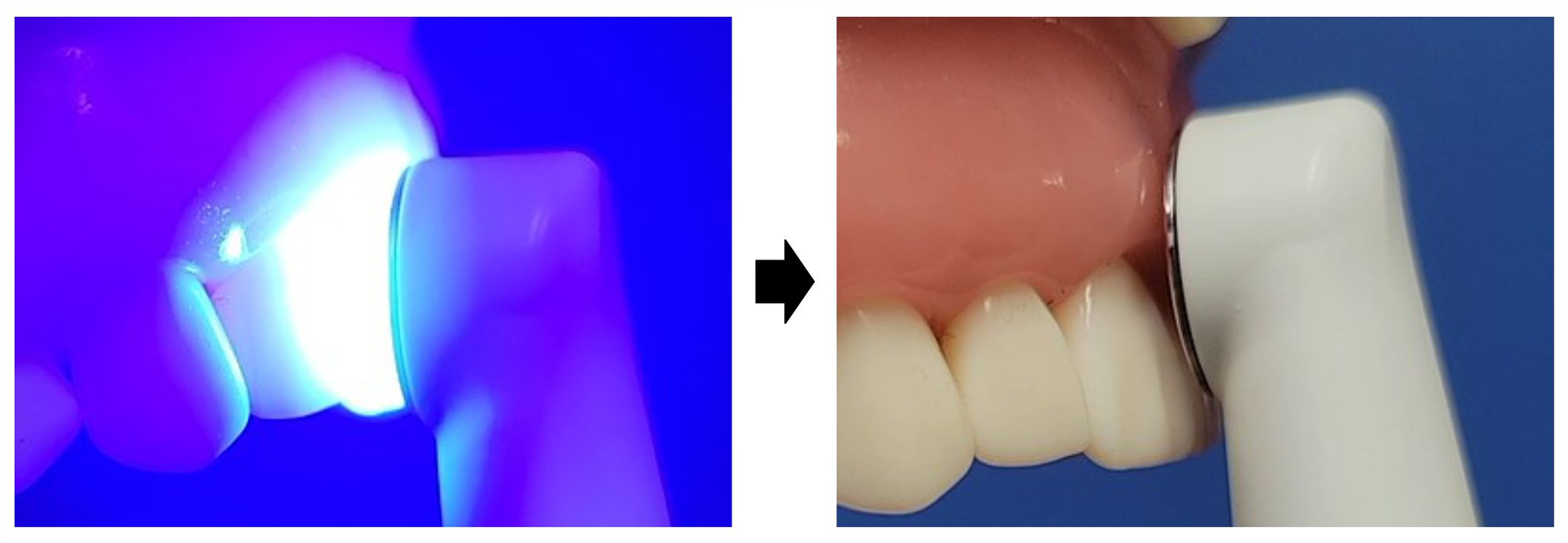 figure 11 - safety gums 1