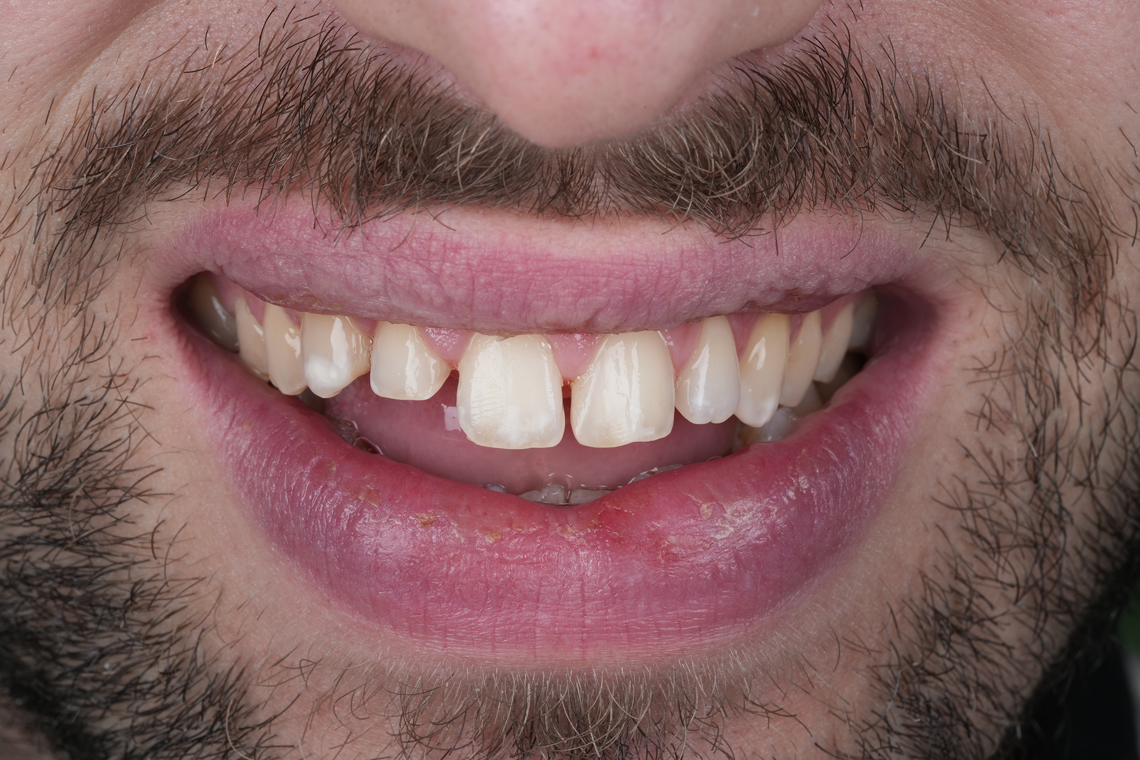 Case Study Image