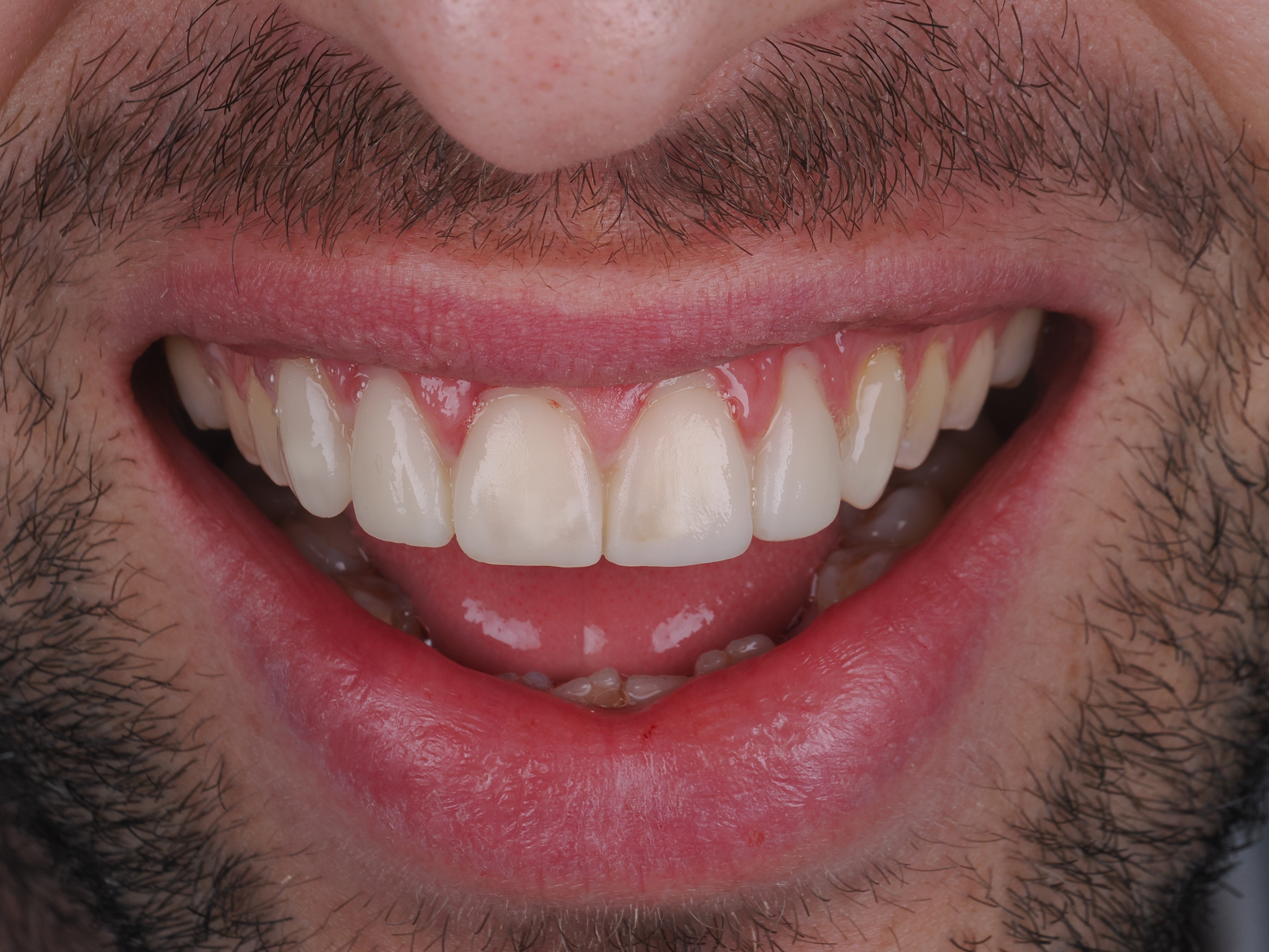 Case Study Image