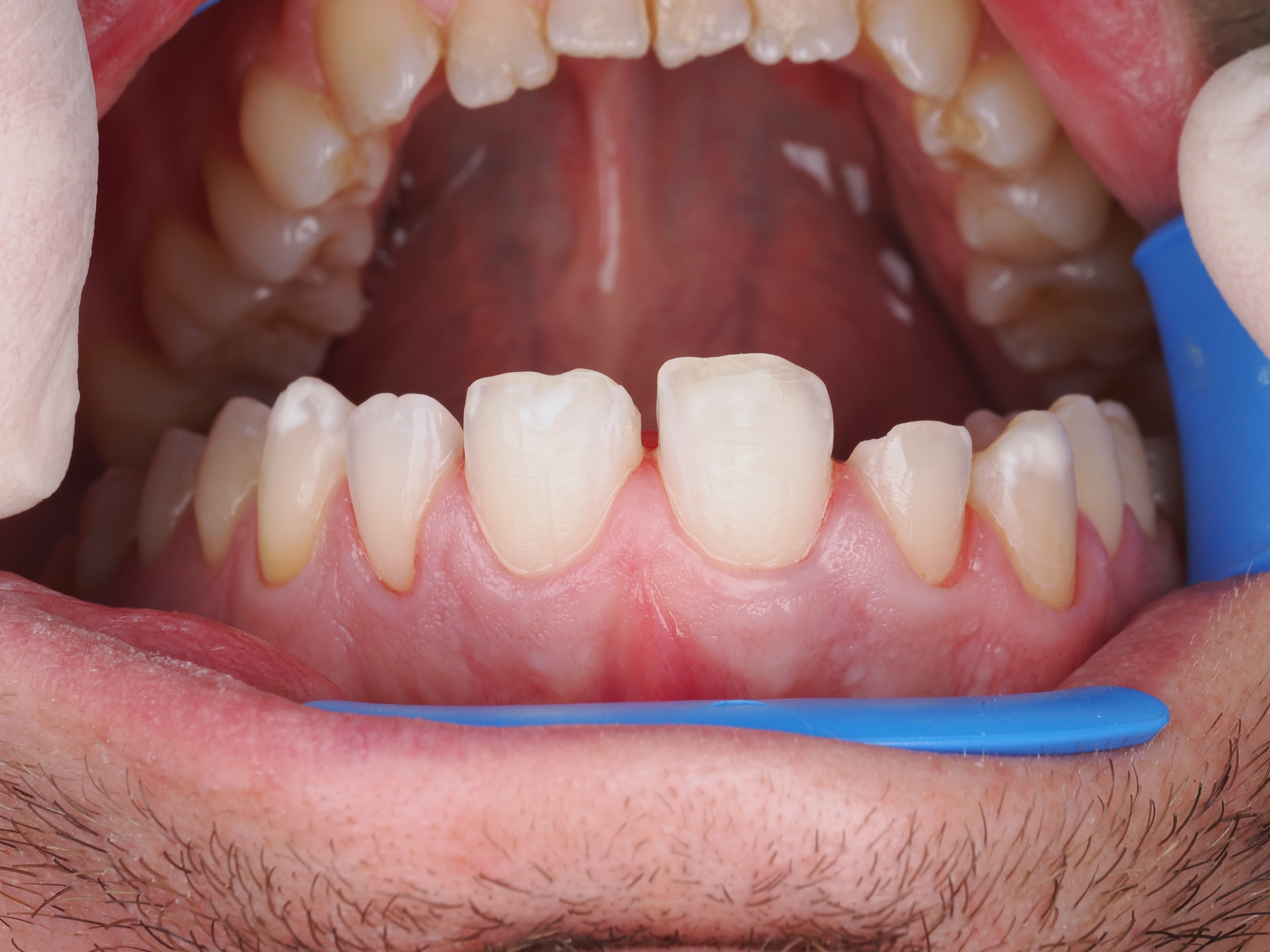 Case Study Image