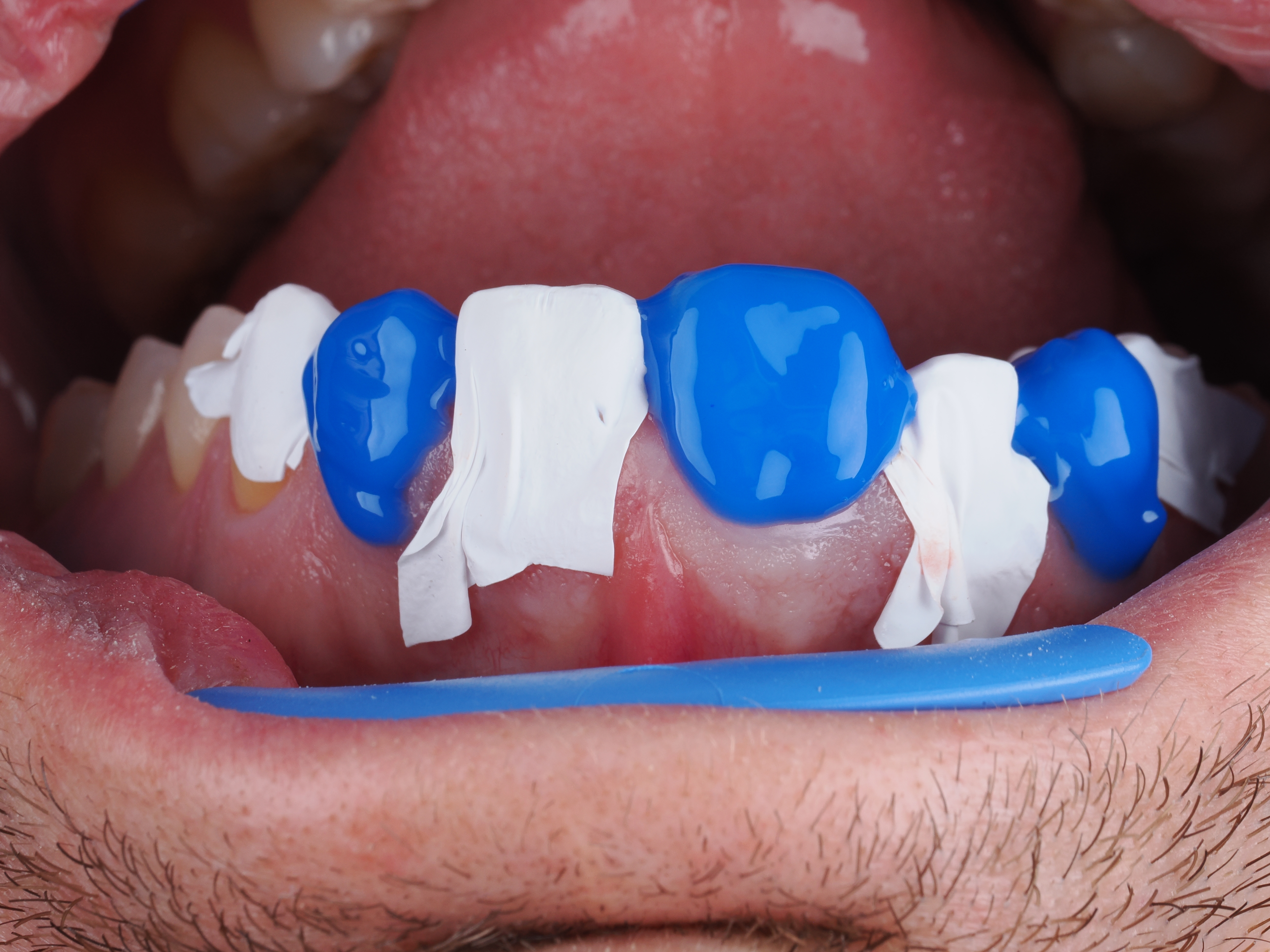 Case Study Image