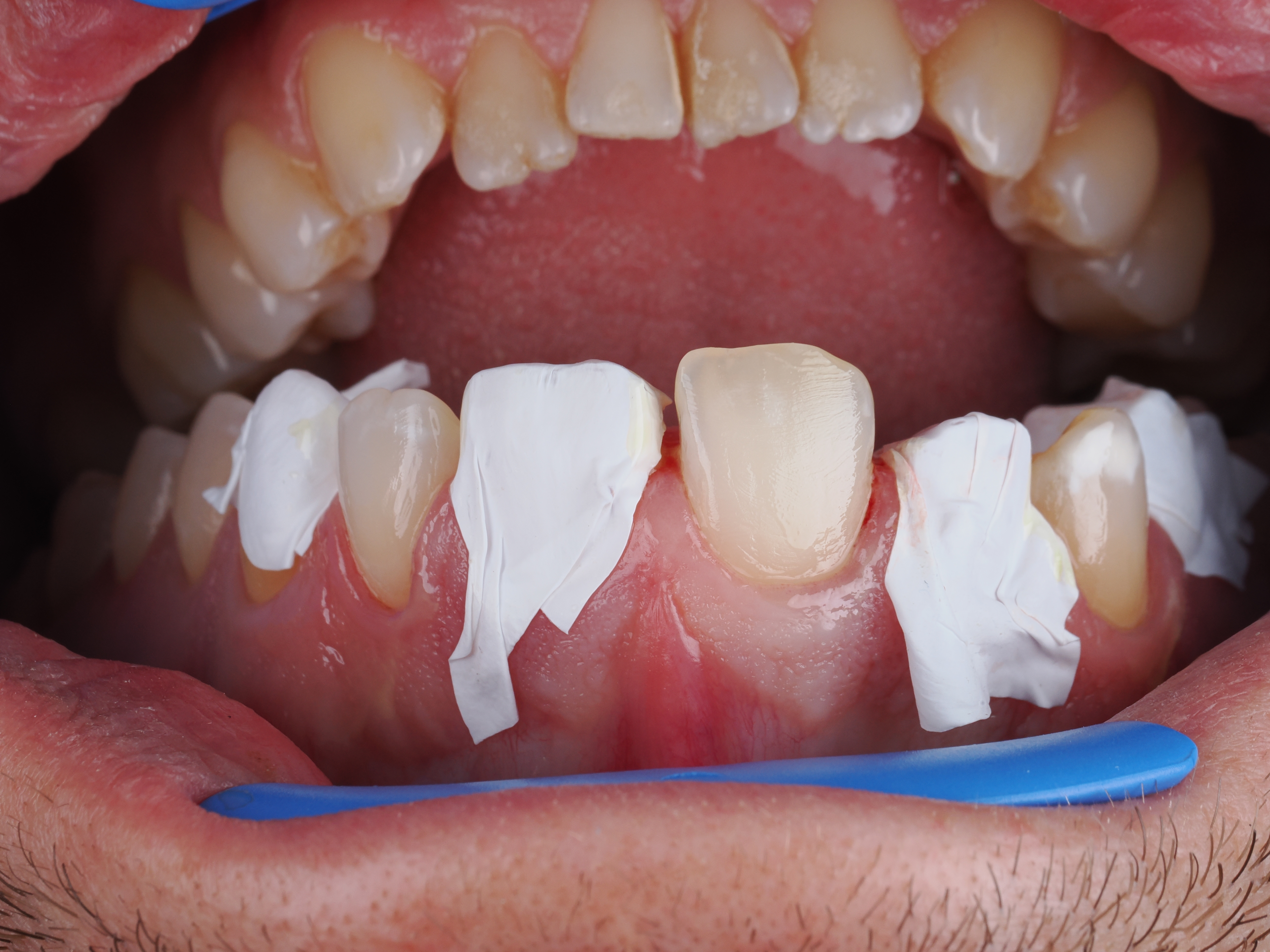 Case Study Image