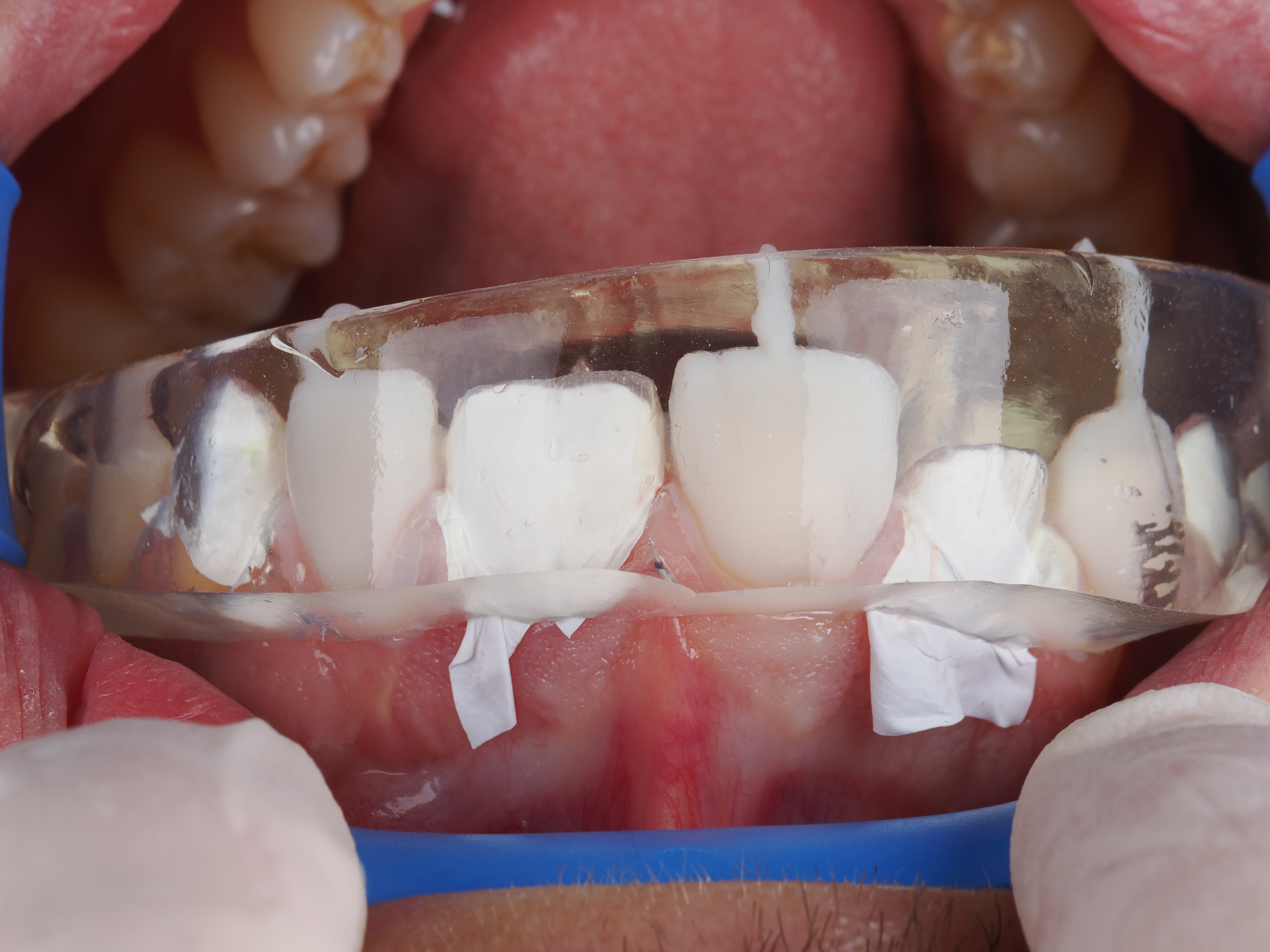 Case Study Image