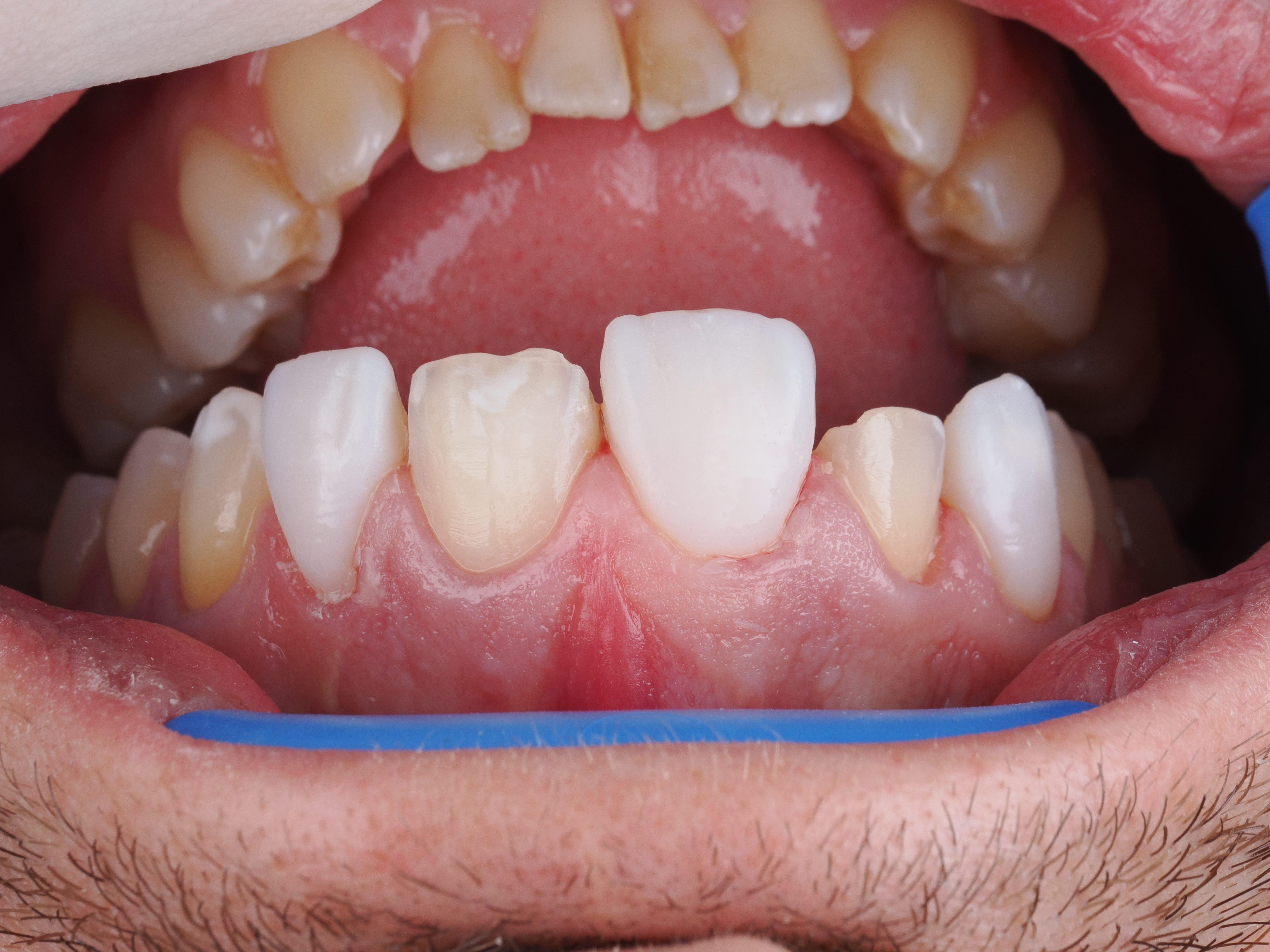 Case Study Image