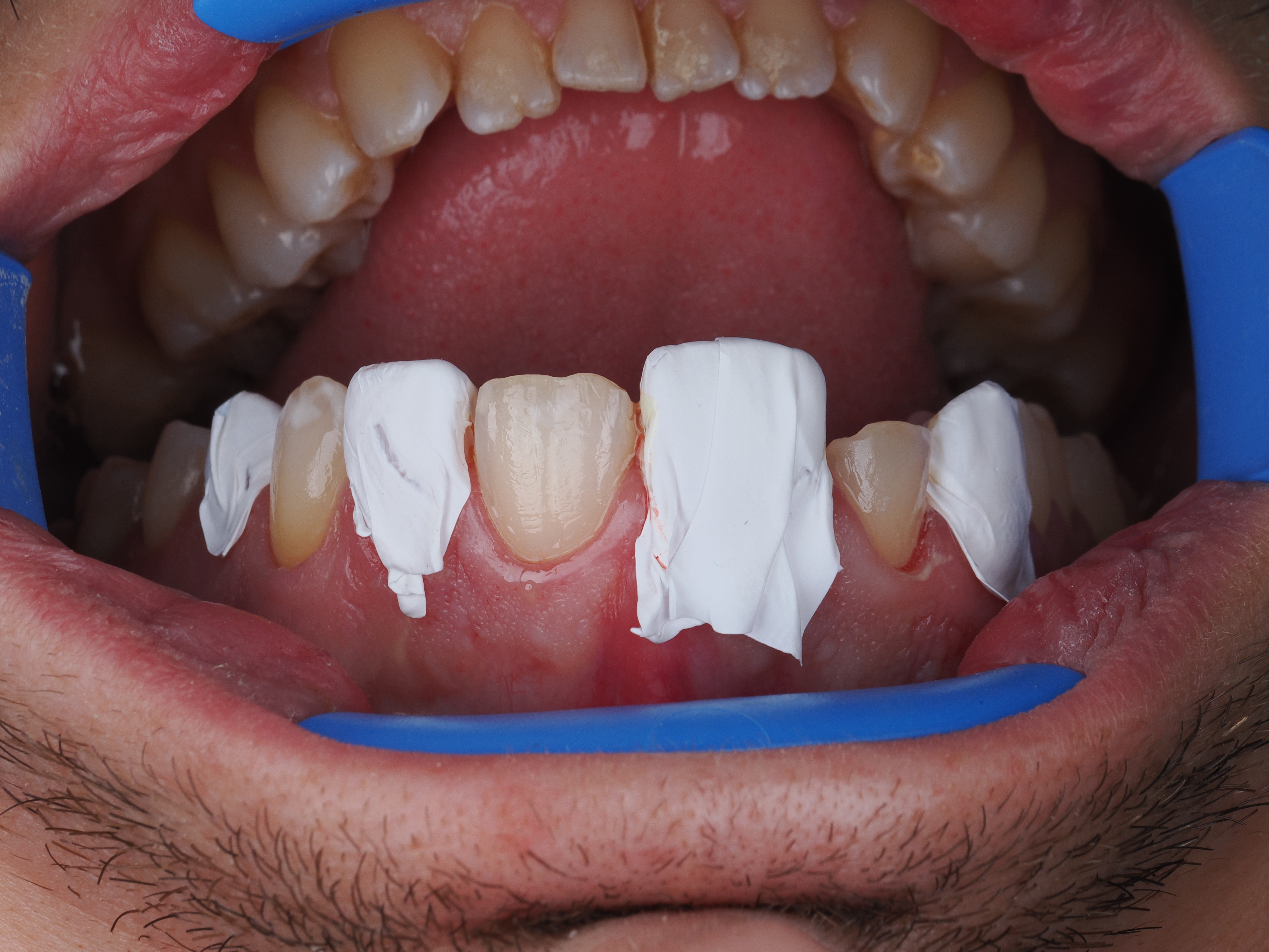 Case Study Image