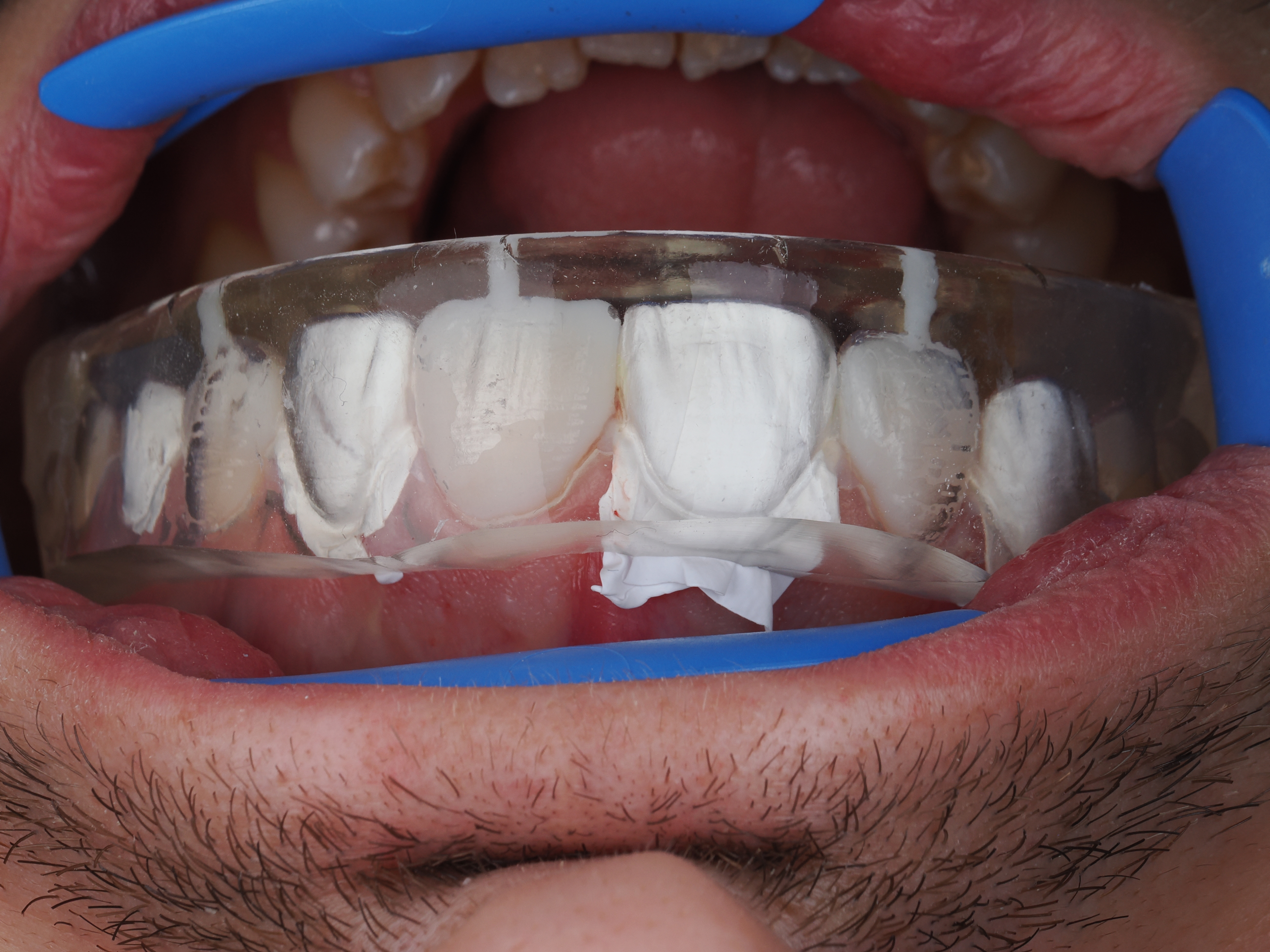 Case Study Image