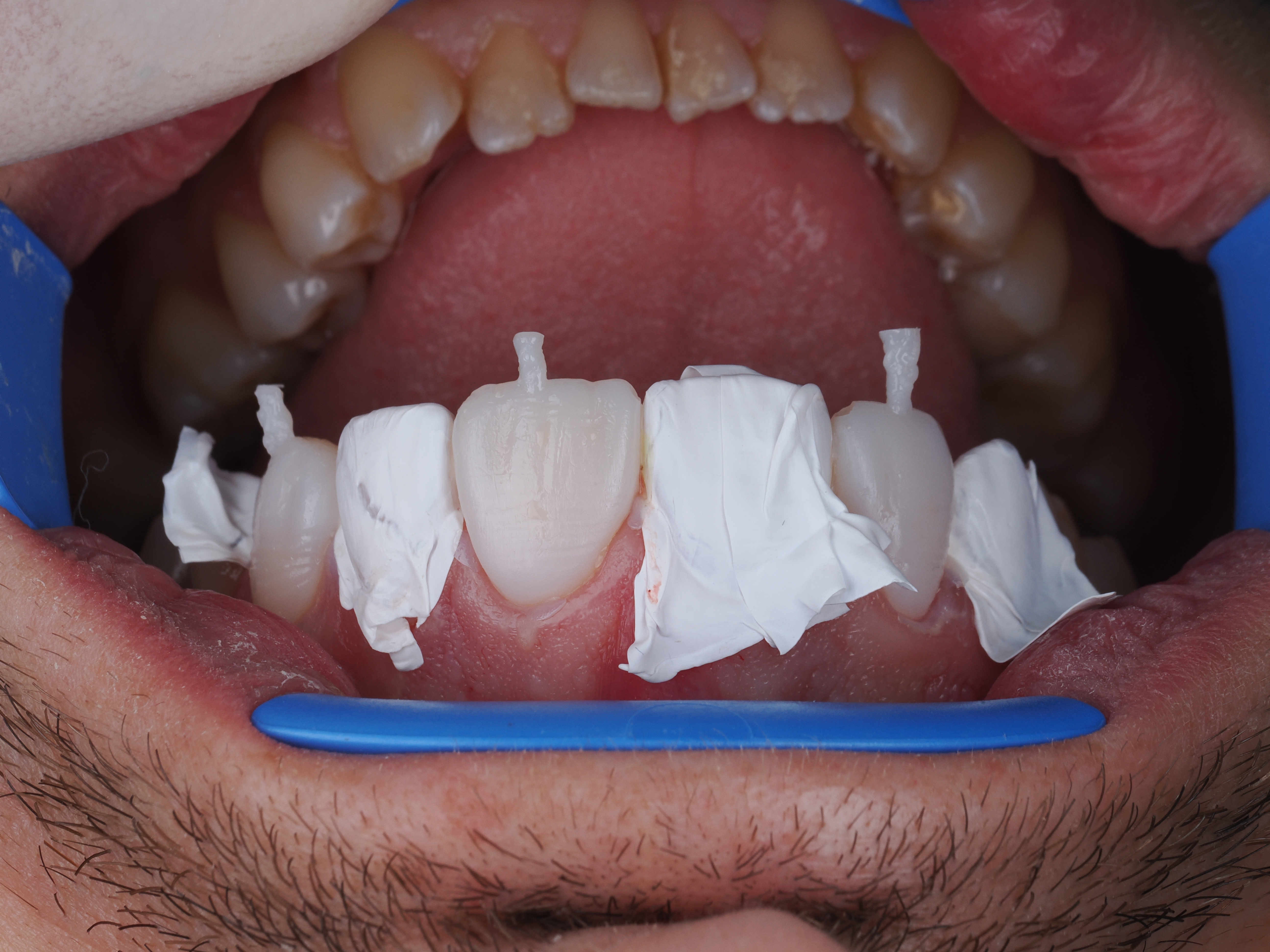 Case Study Image