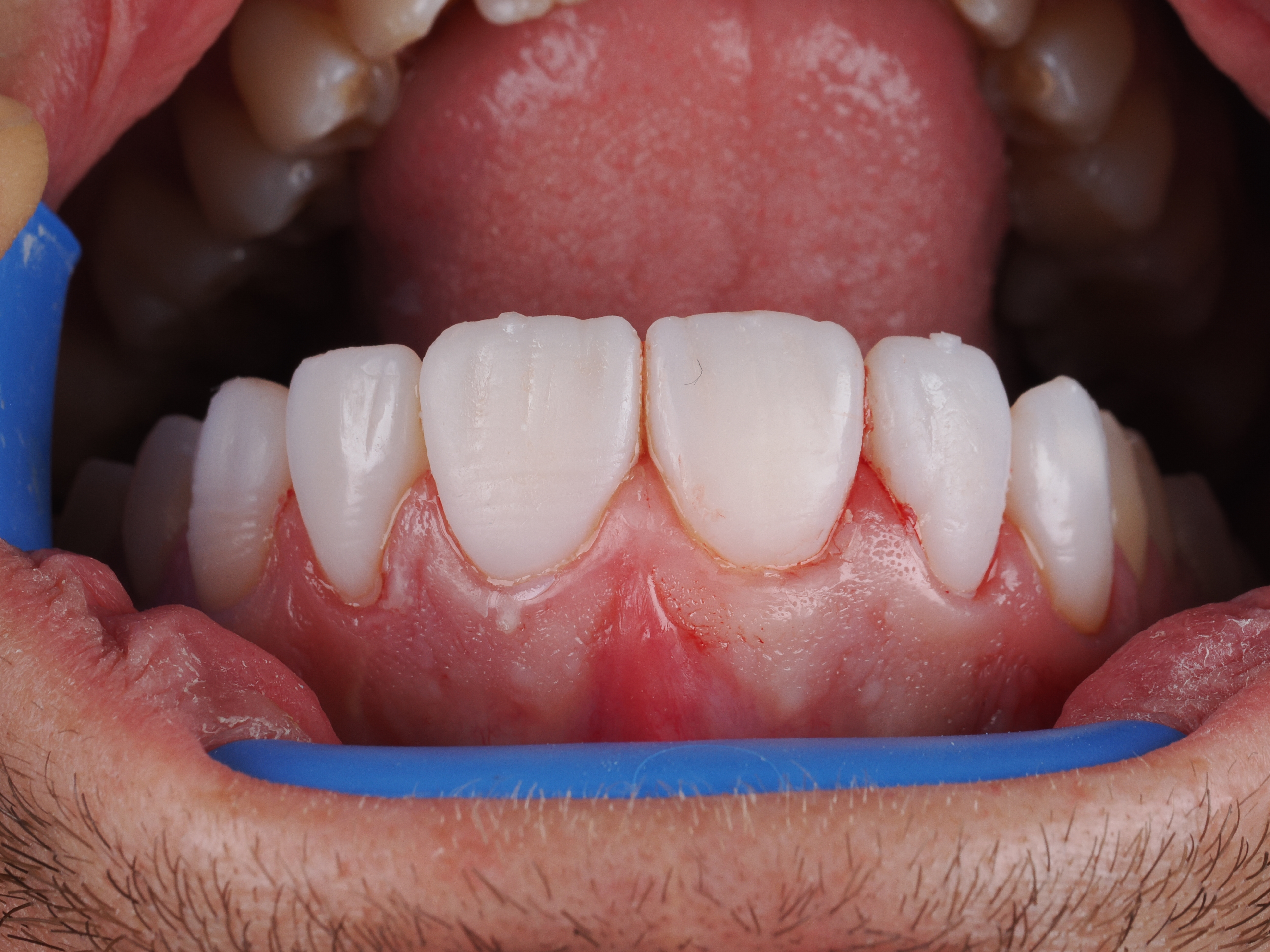 Case Study Image