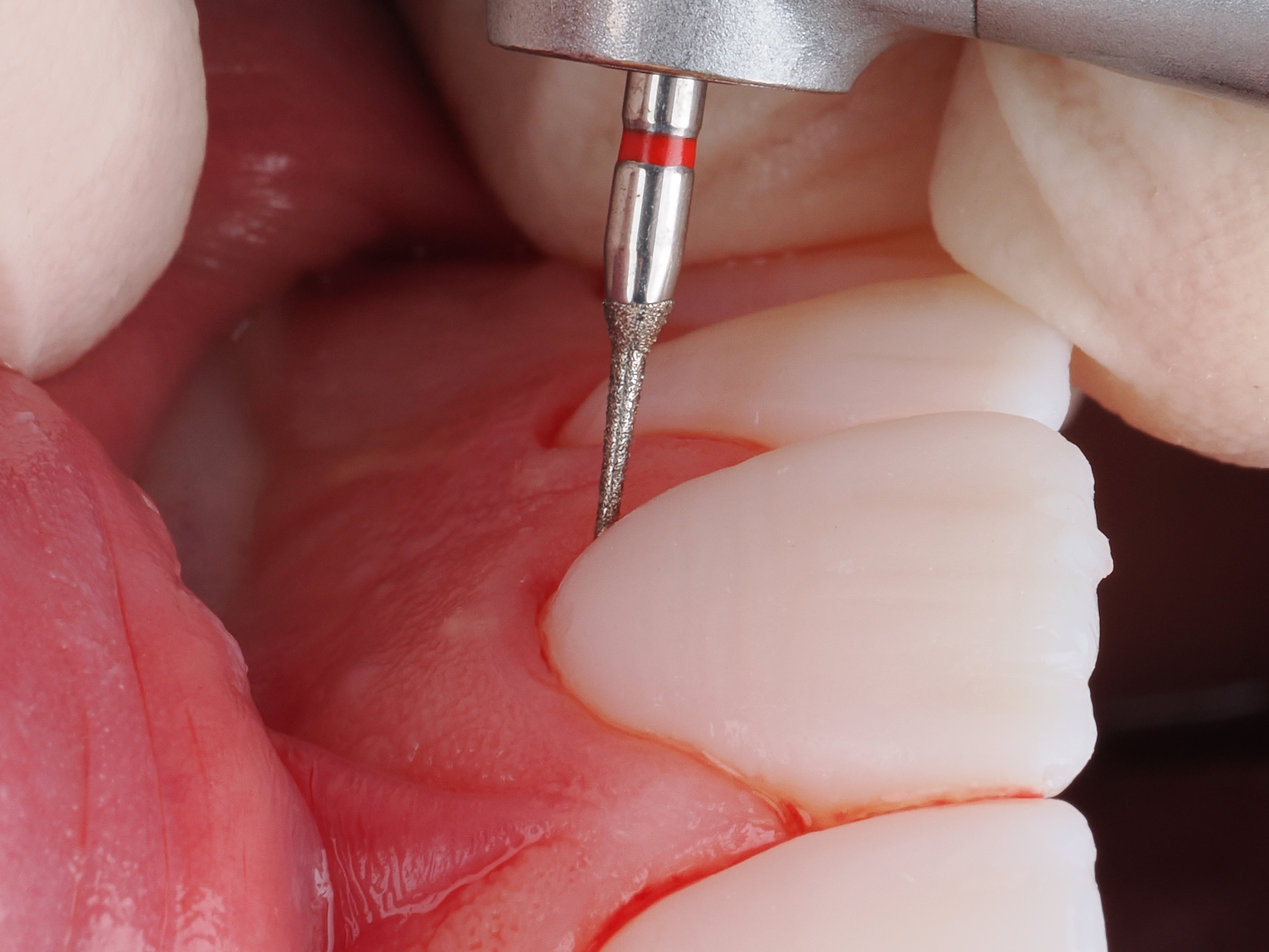 Case Study Image