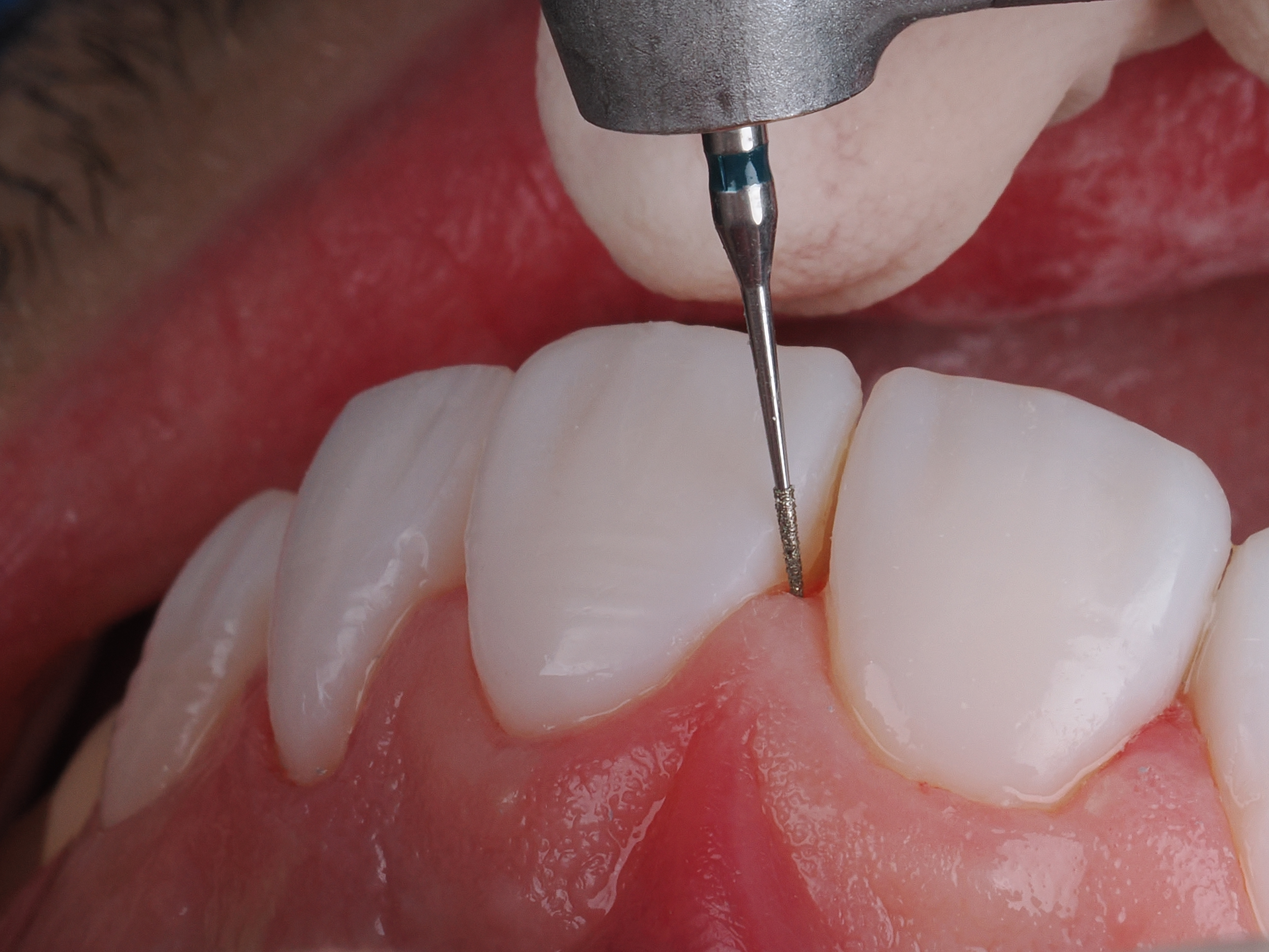 Case Study Image