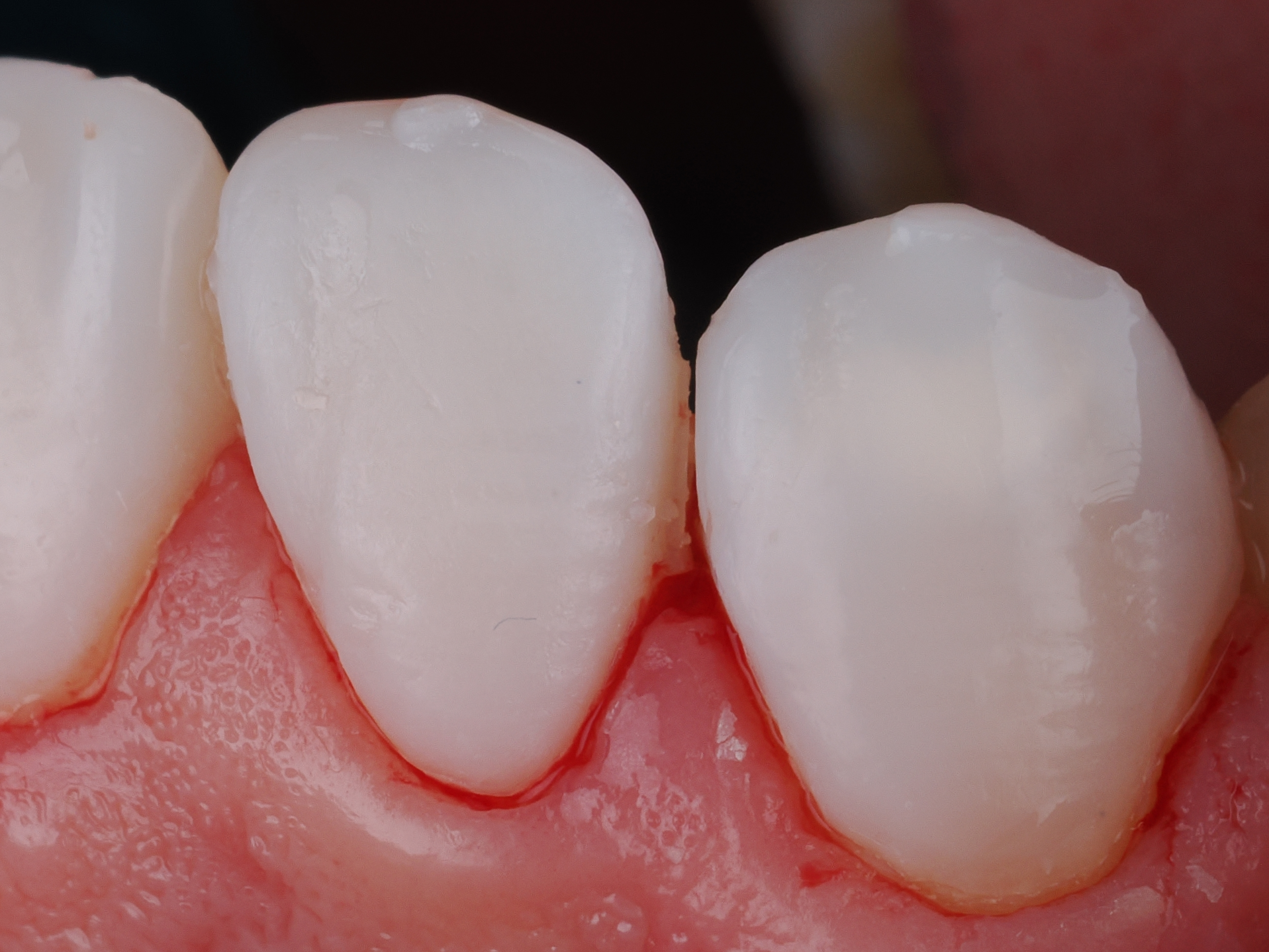 Case Study Image