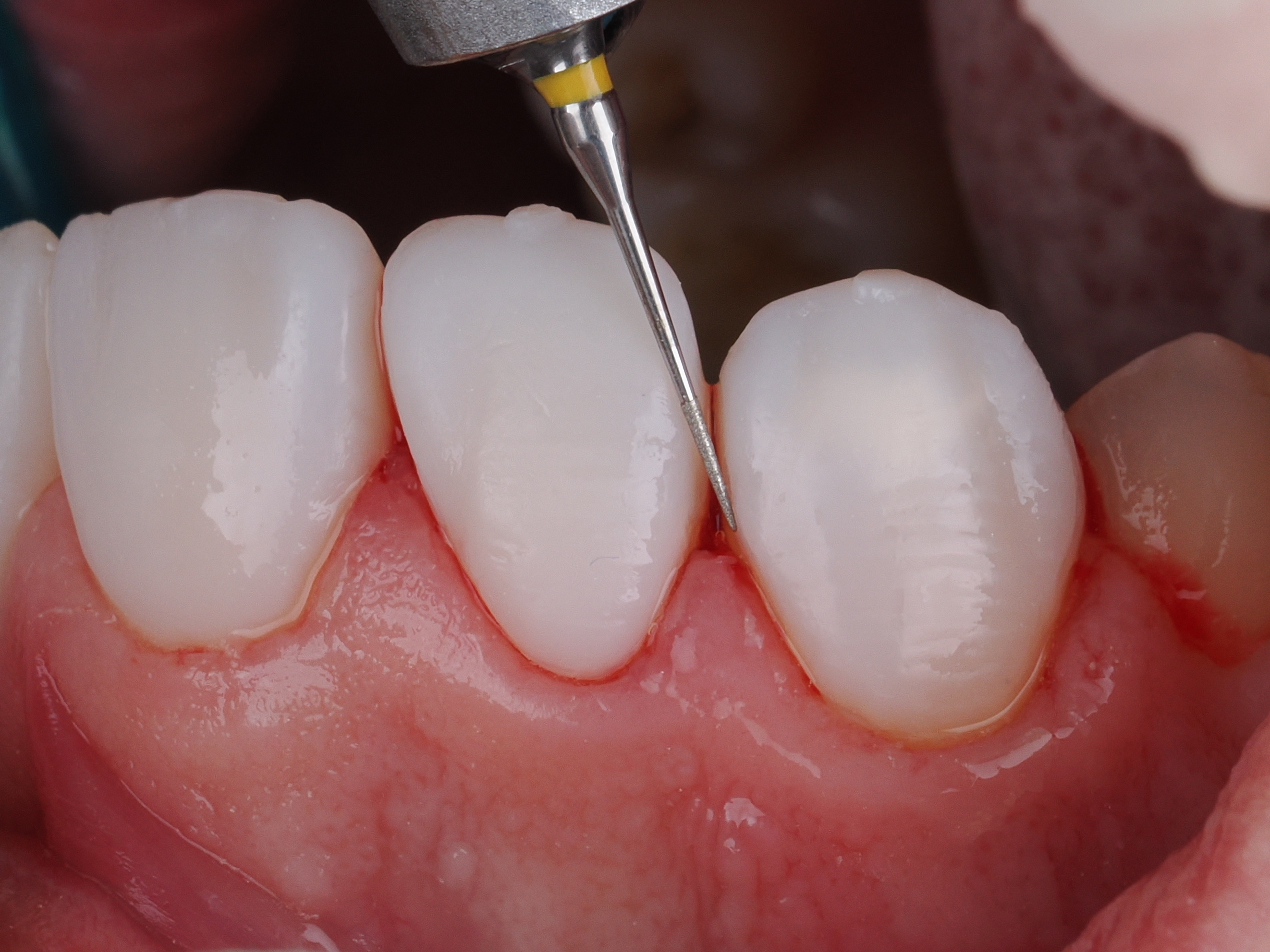 Case Study Image