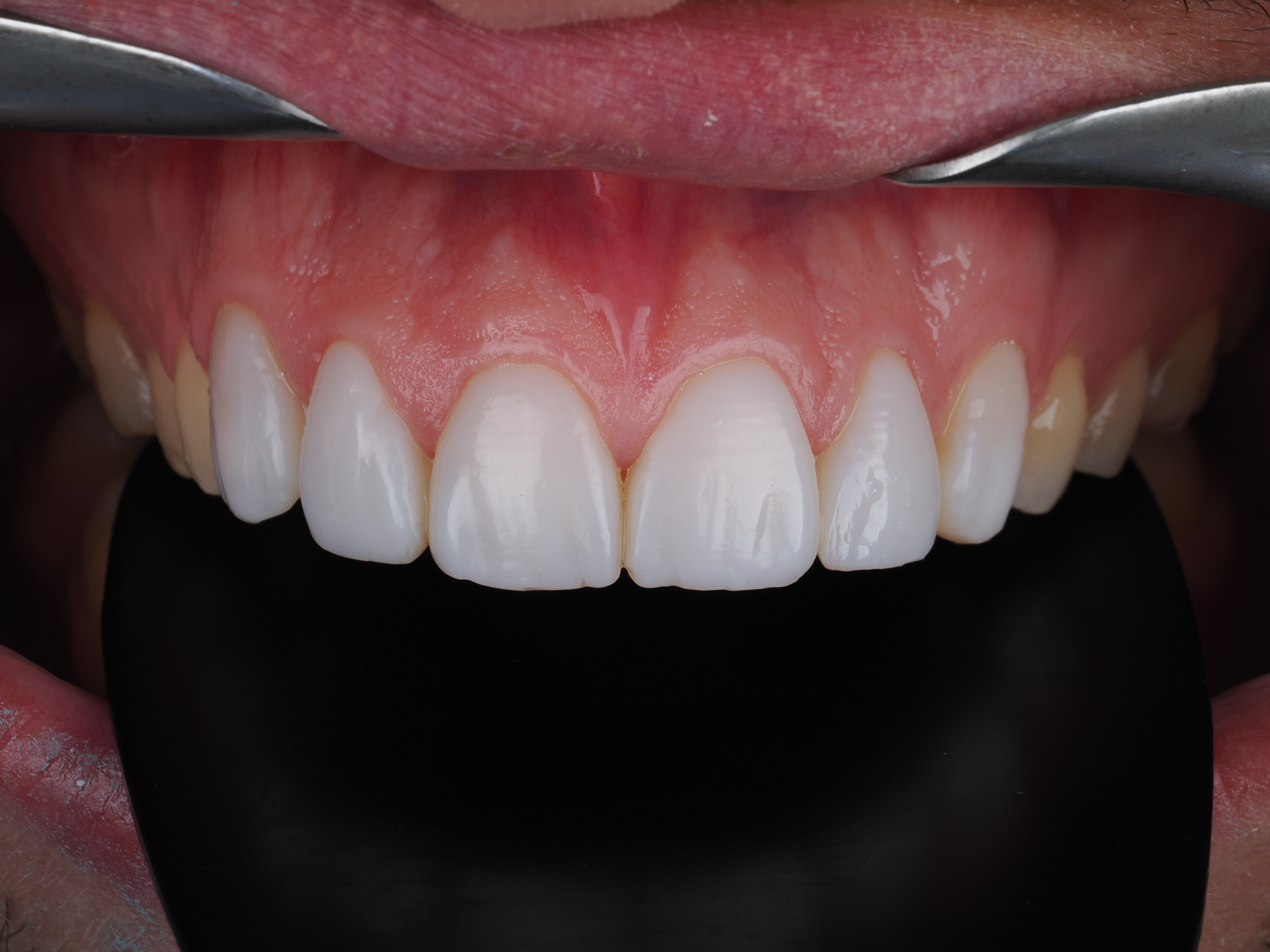 Case Study Image