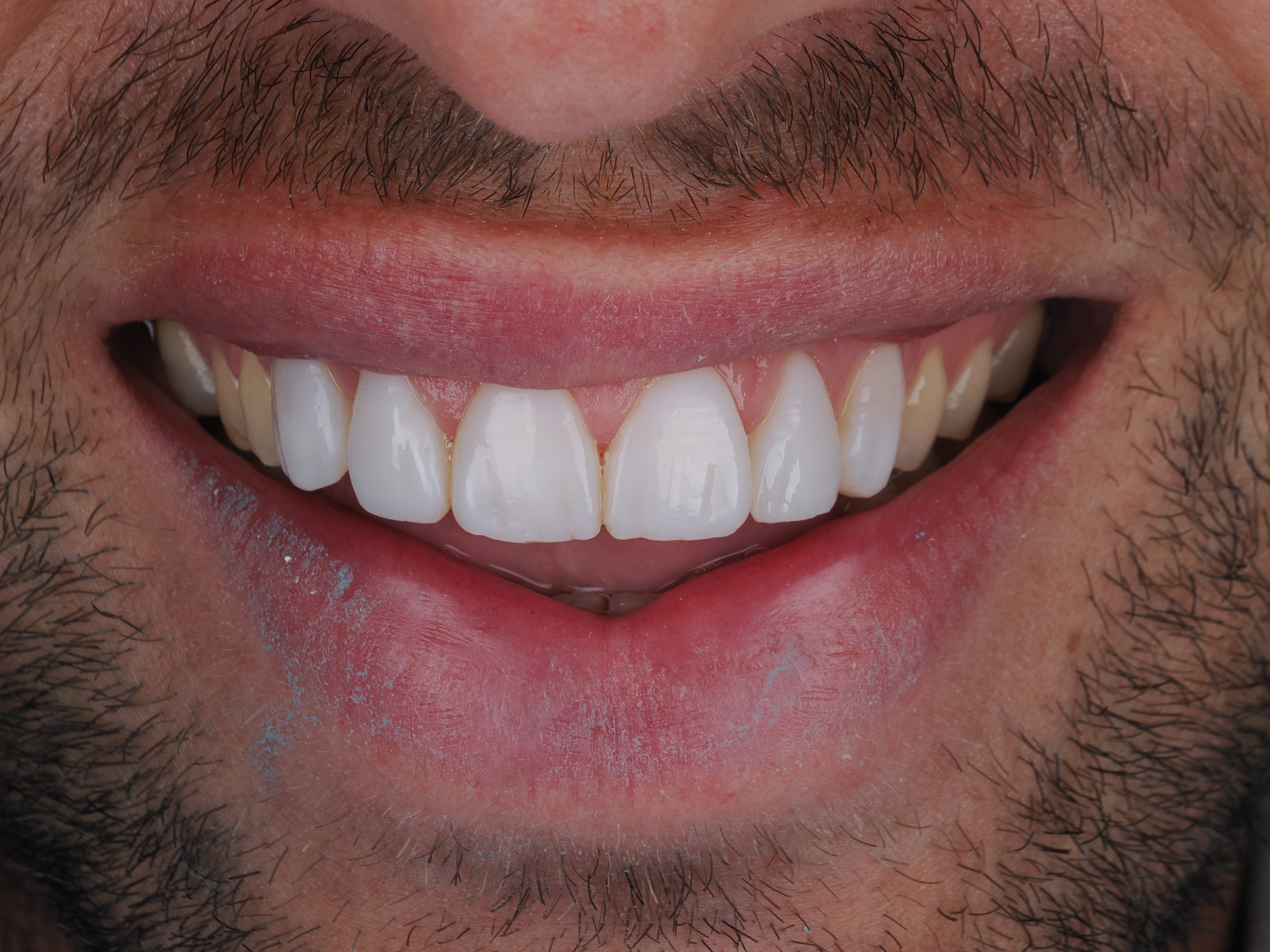 Case Study Image