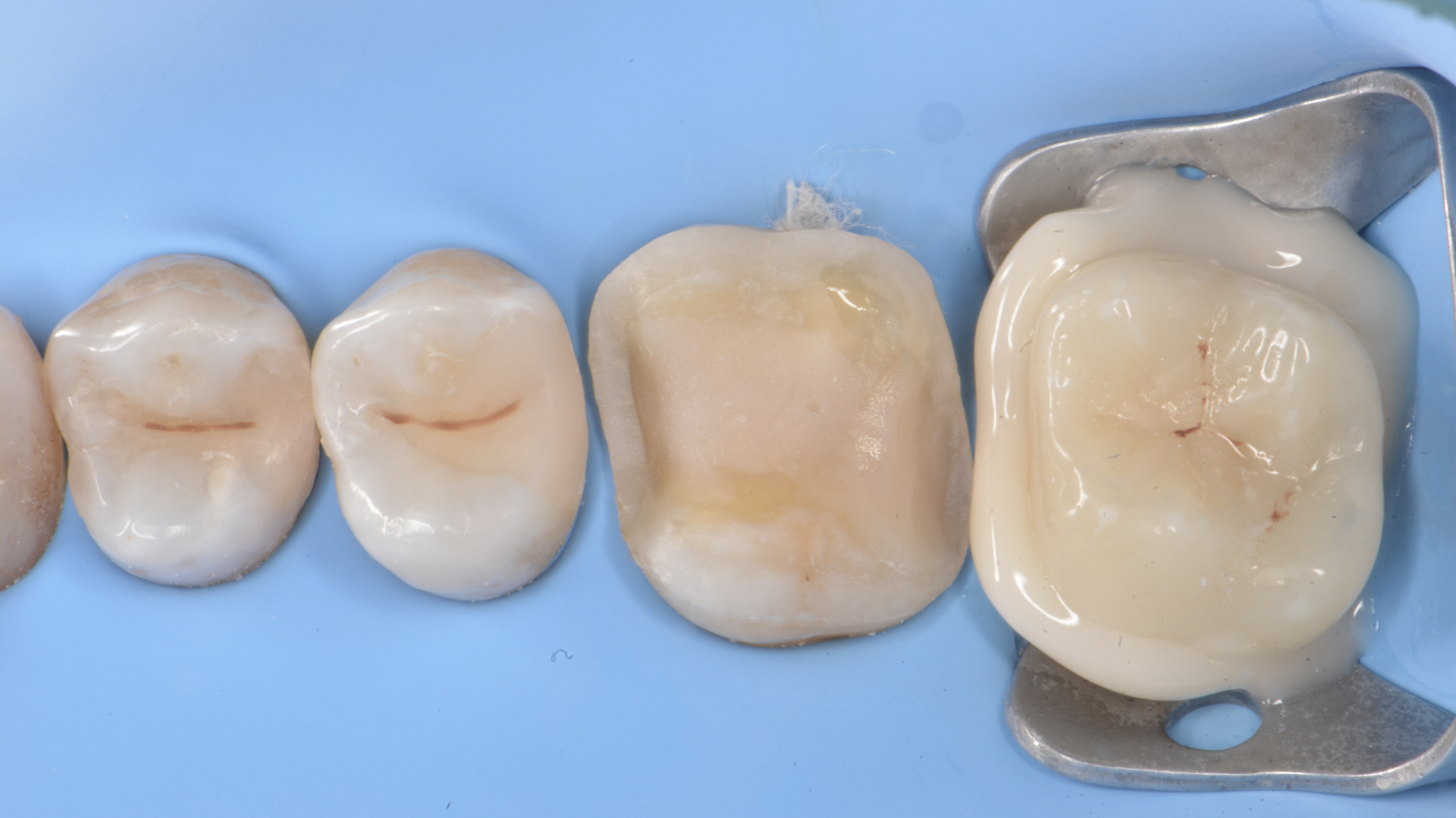 Figure 10