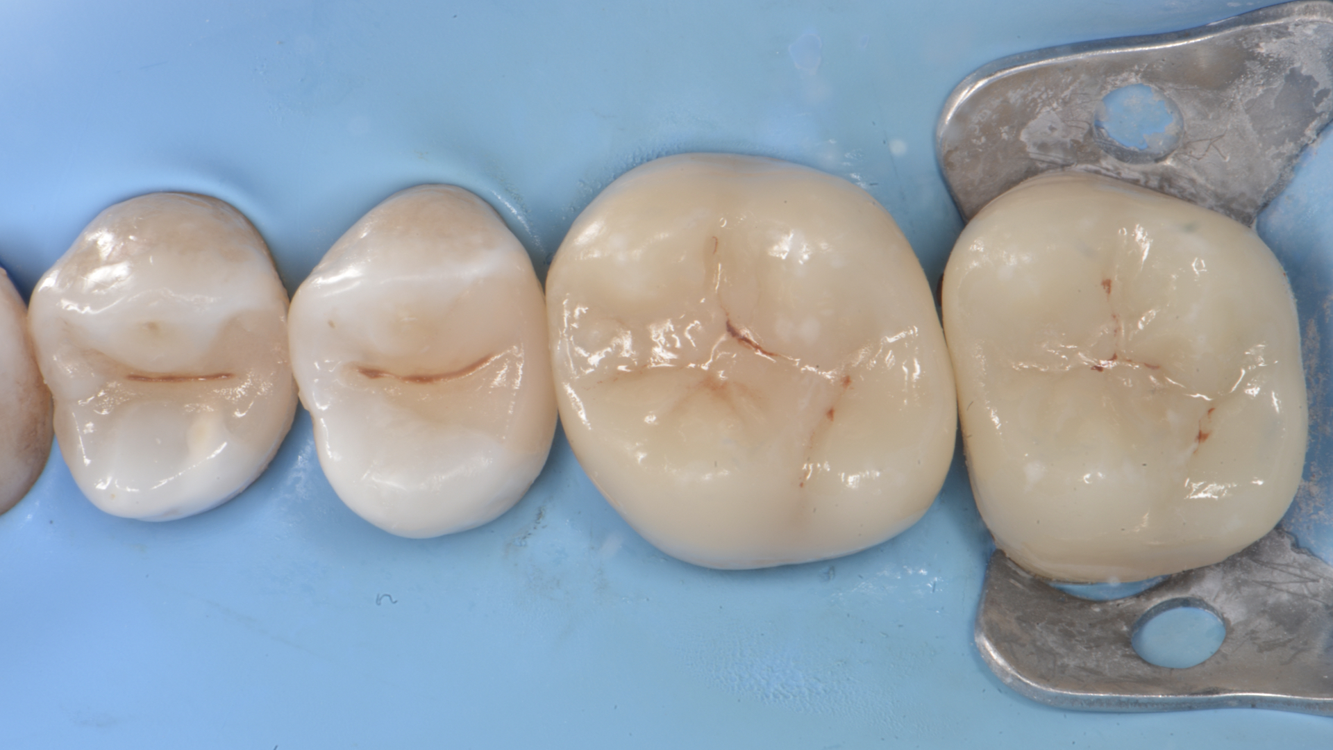Figure 11