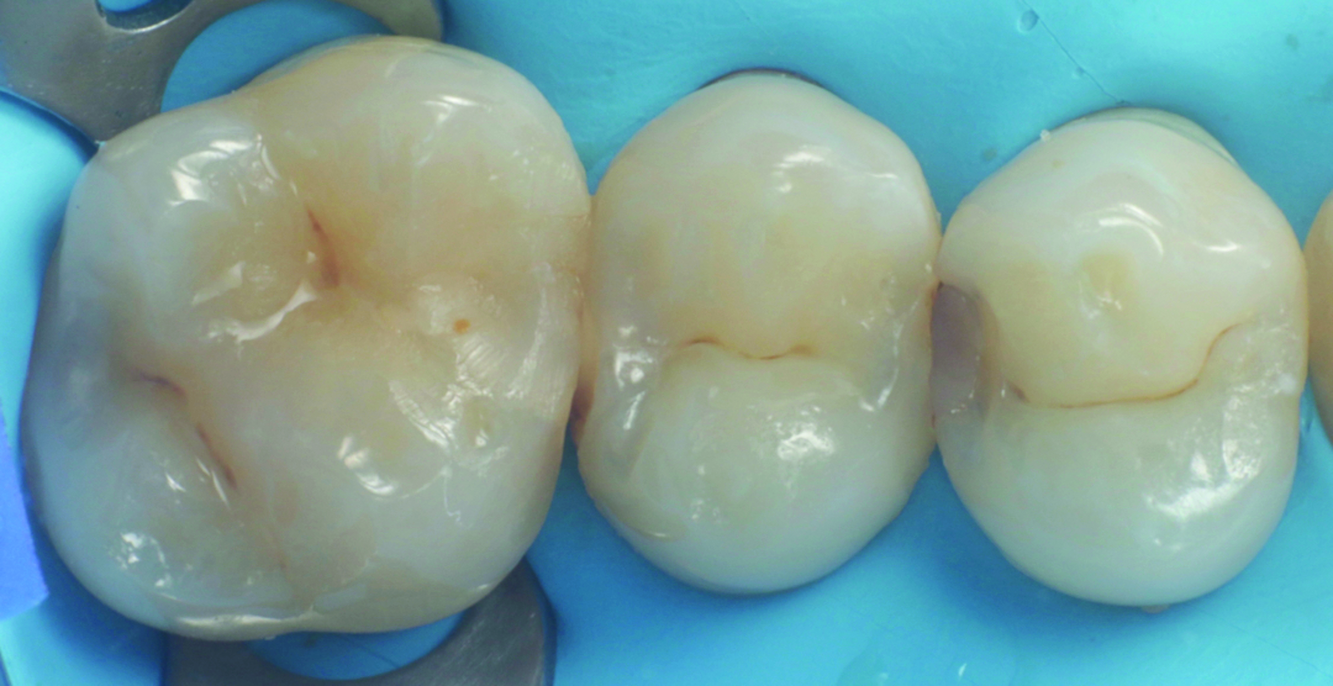 HenarejosVictor_CASE I.002_013025 Figure 1