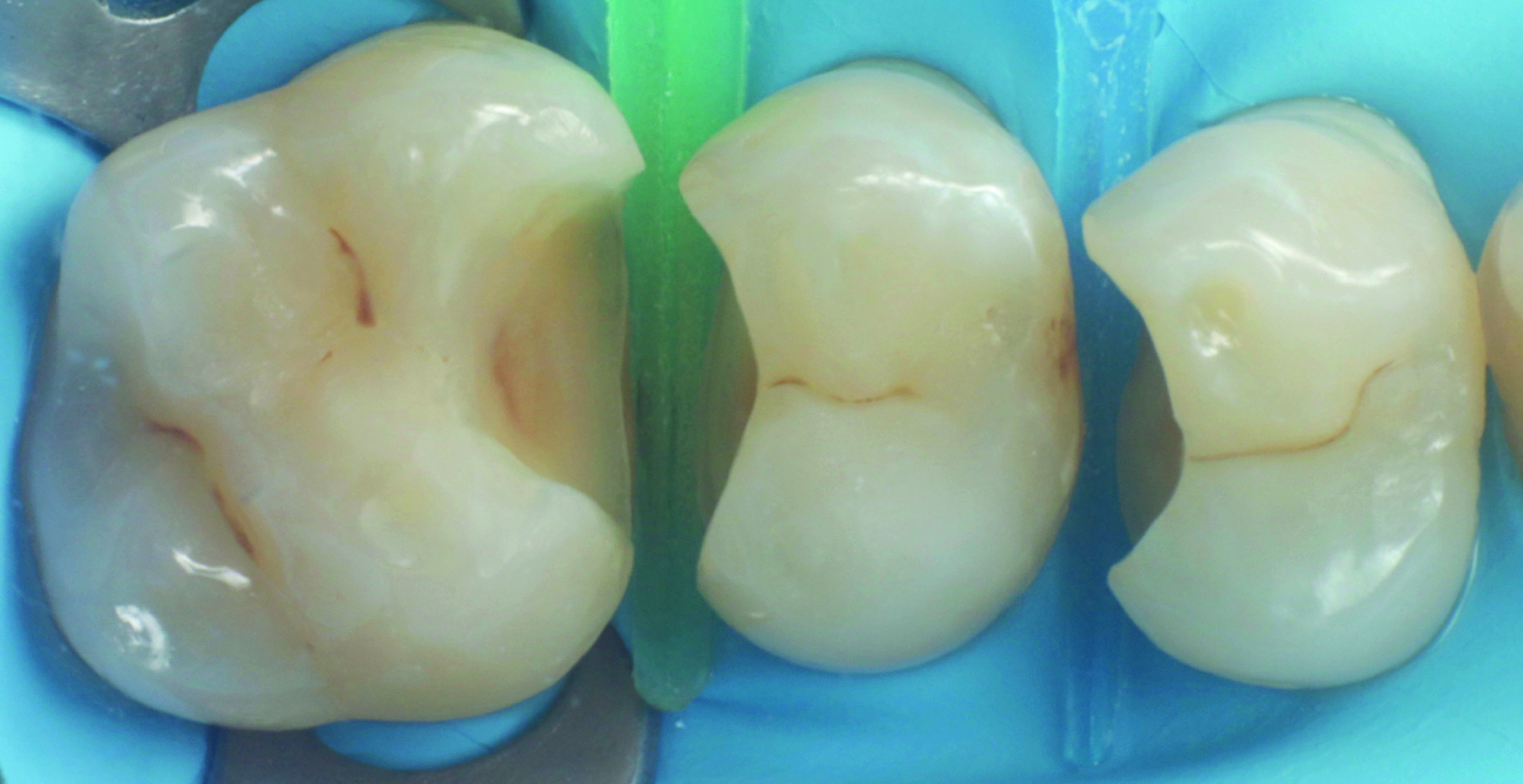 HenarejosVictor_CASE I.003_013025 Figure 2