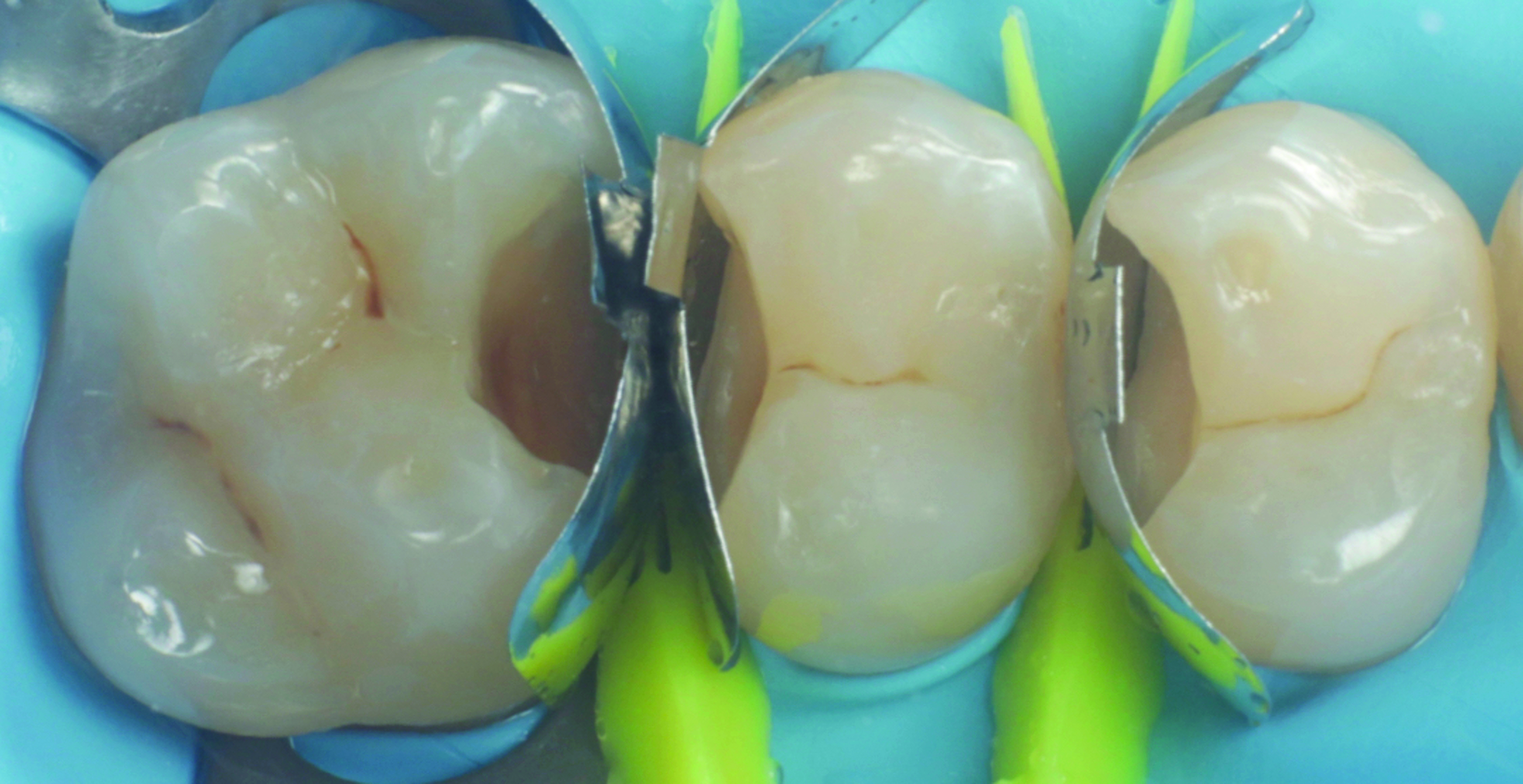 HenarejosVictor_CASE I.004_013025 Figure 3