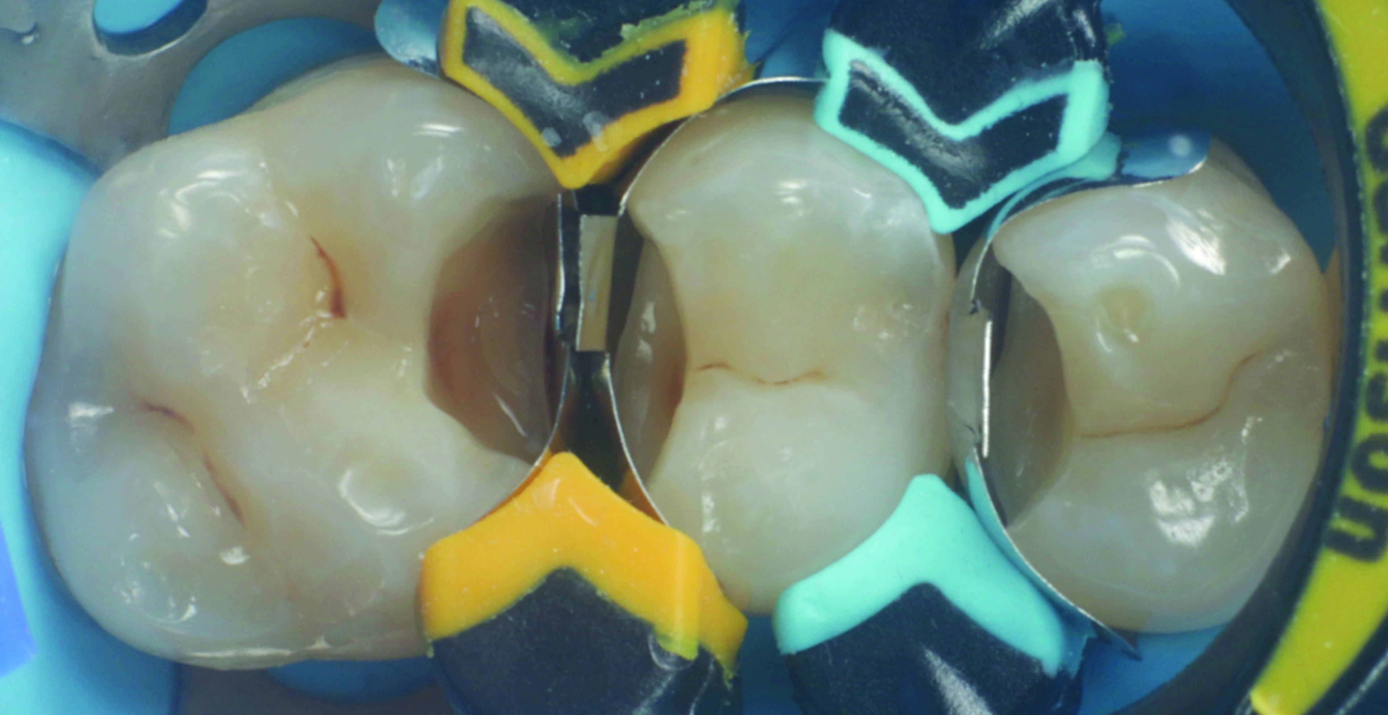 HenarejosVictor_CASE I.005_013025 Figure 4