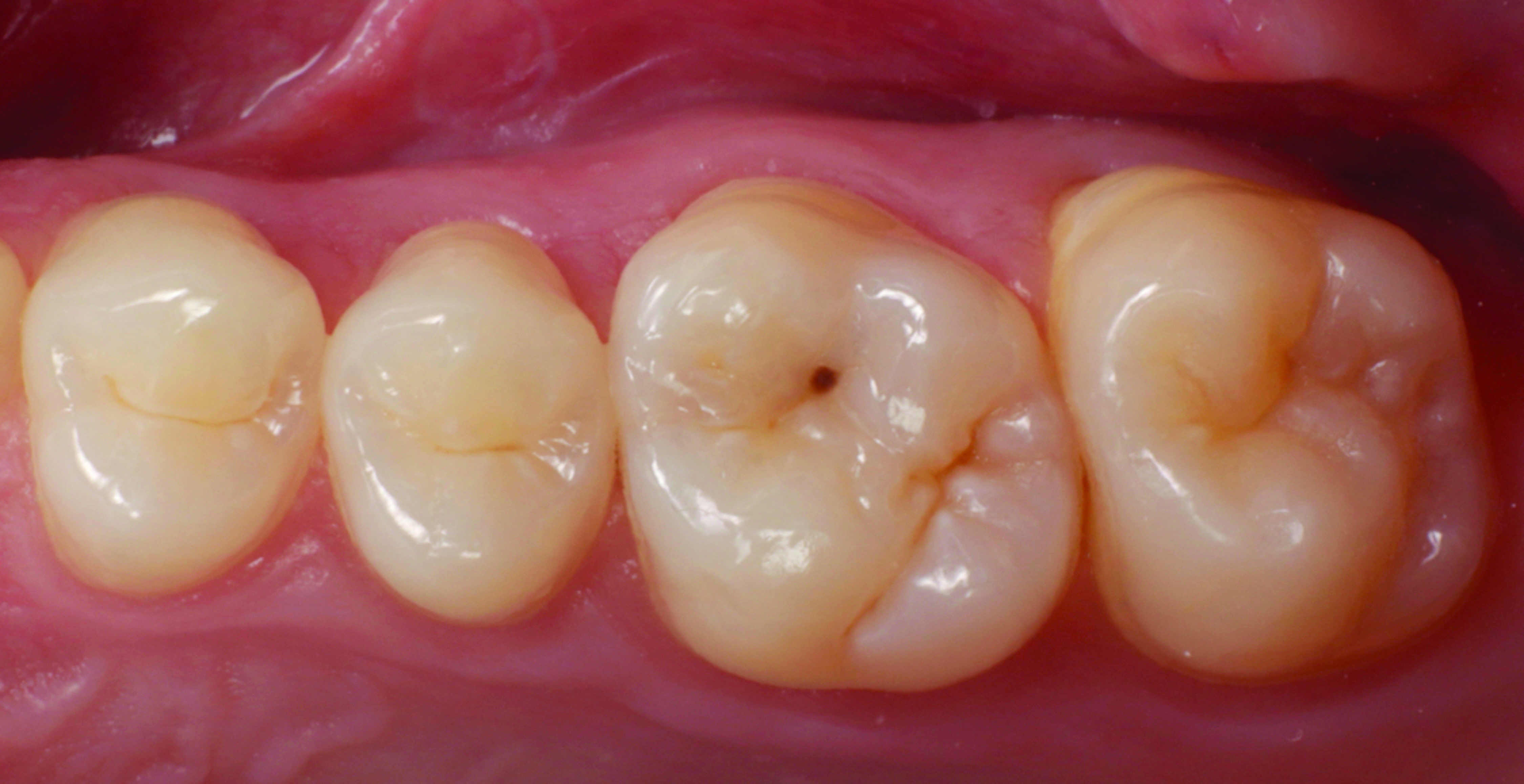 HenarejosVictor_CASE II.001_013025 Figure 1