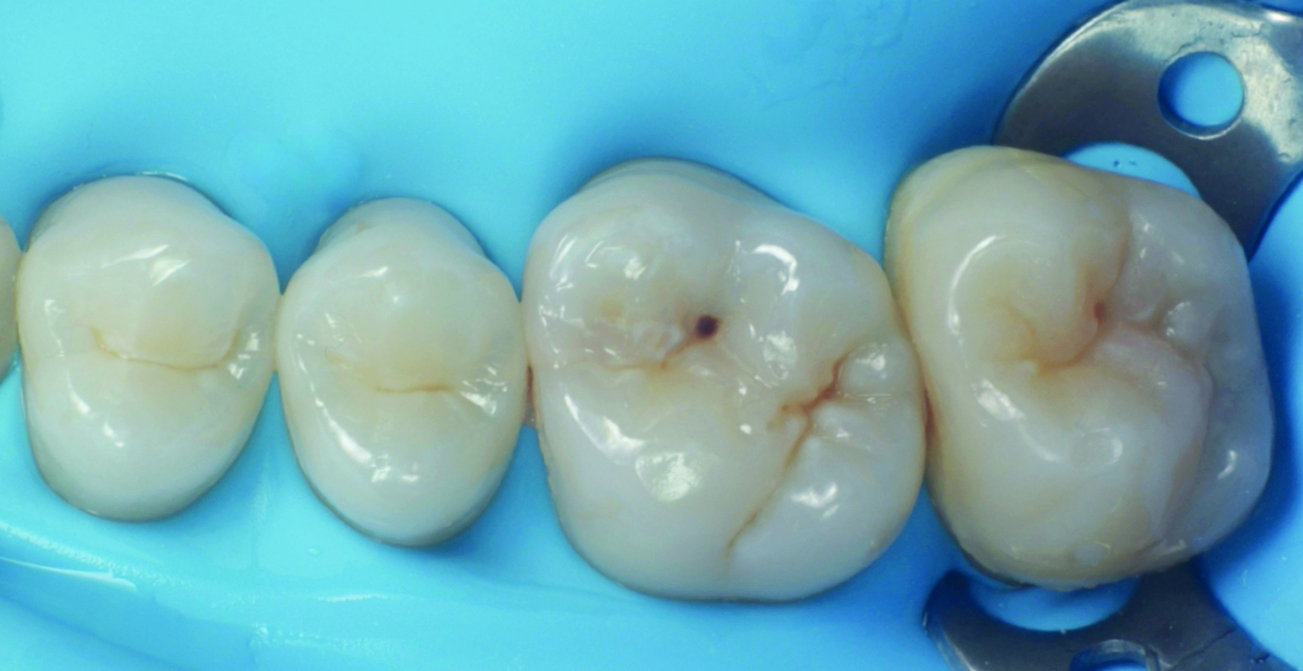 HenarejosVictor_CASE II.002_013025 Figure 2