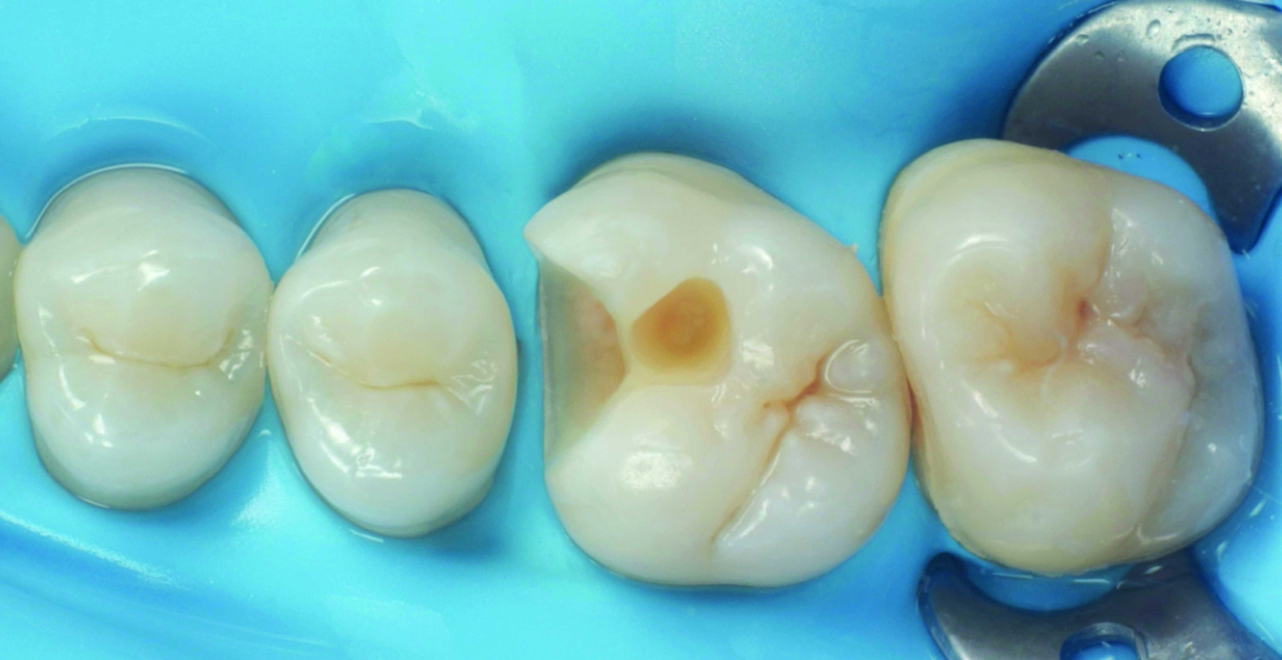 HenarejosVictor_CASE II.003_013025 Figure 3