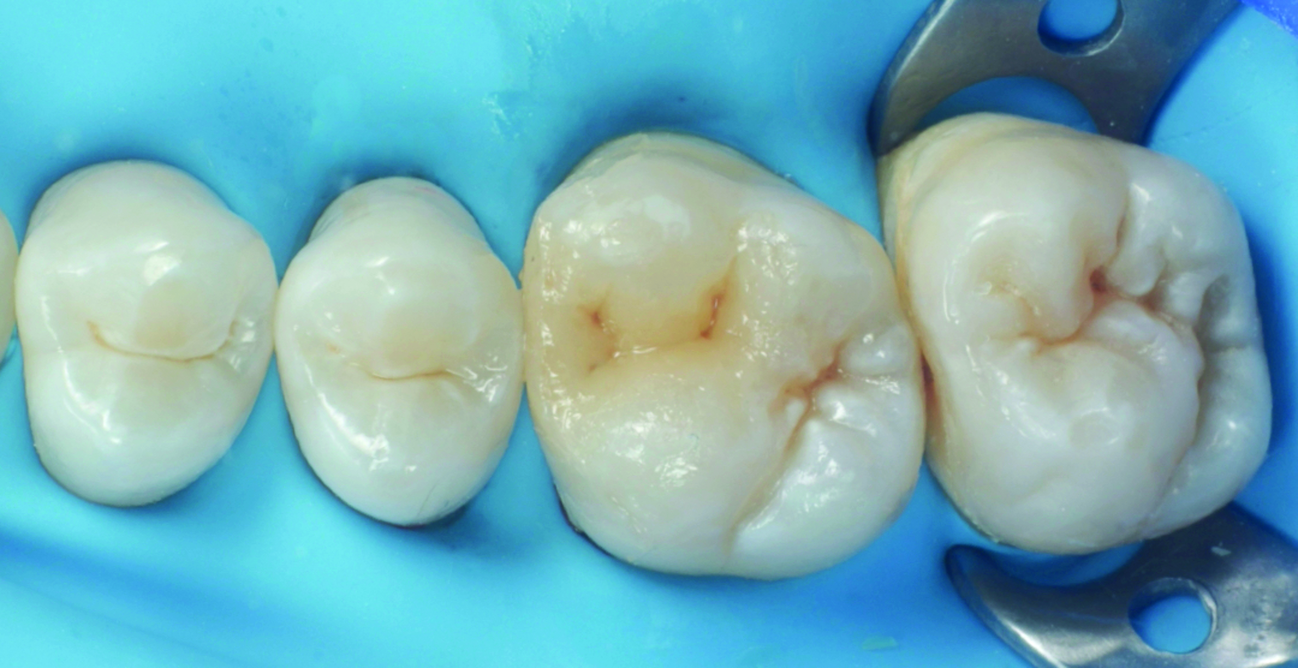 HenarejosVictor_CASE II.006_013025 Figure 6