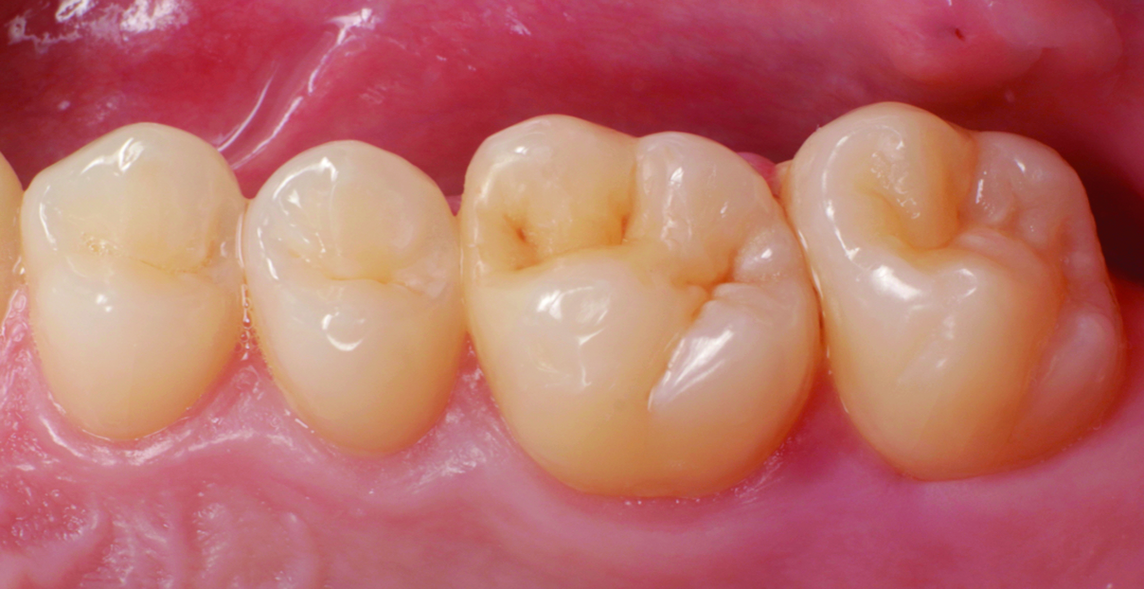 HenarejosVictor_CASE II.009_013025 Figure 9