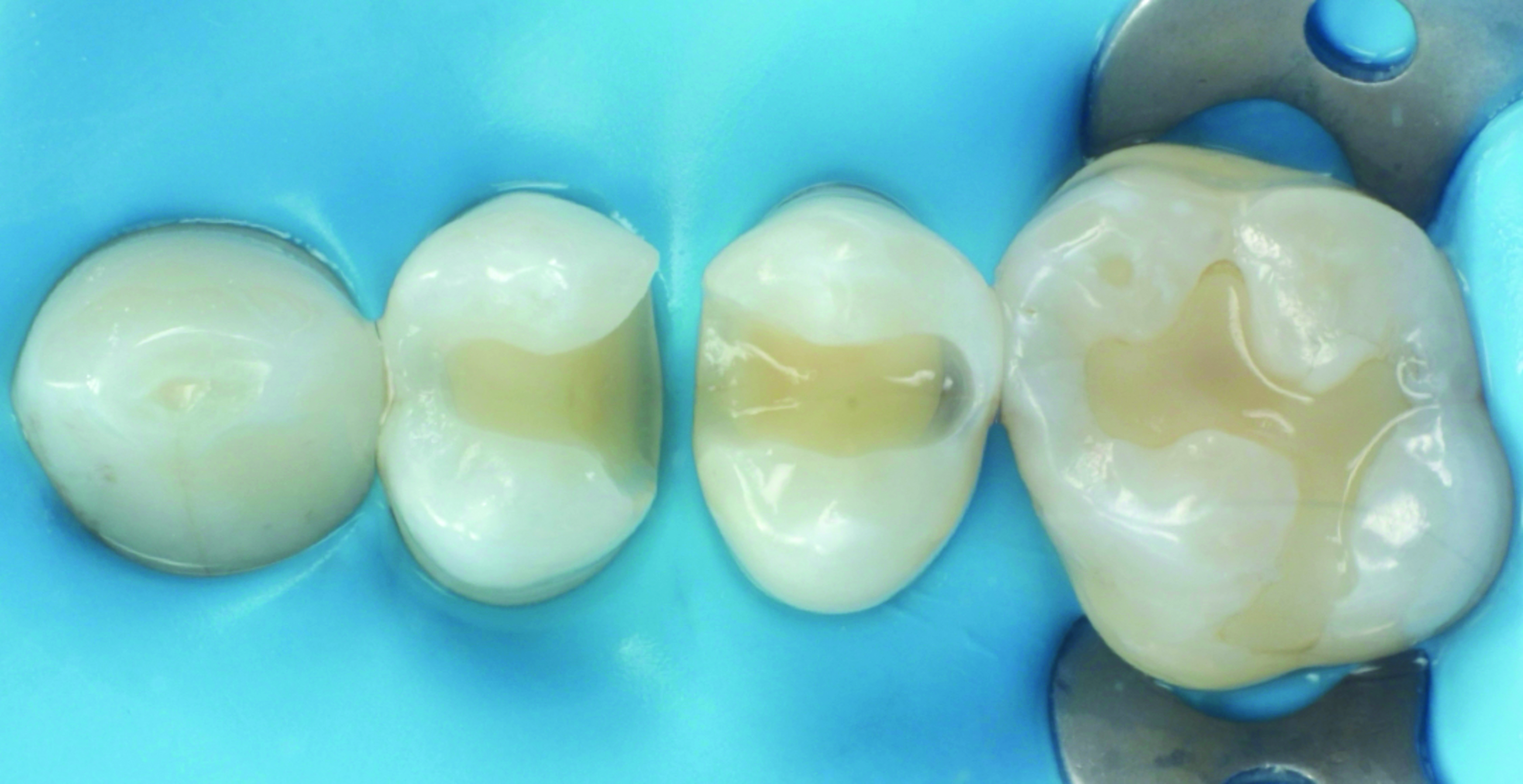 HenarejosVictor_CASE III.002_013025 Figure 2