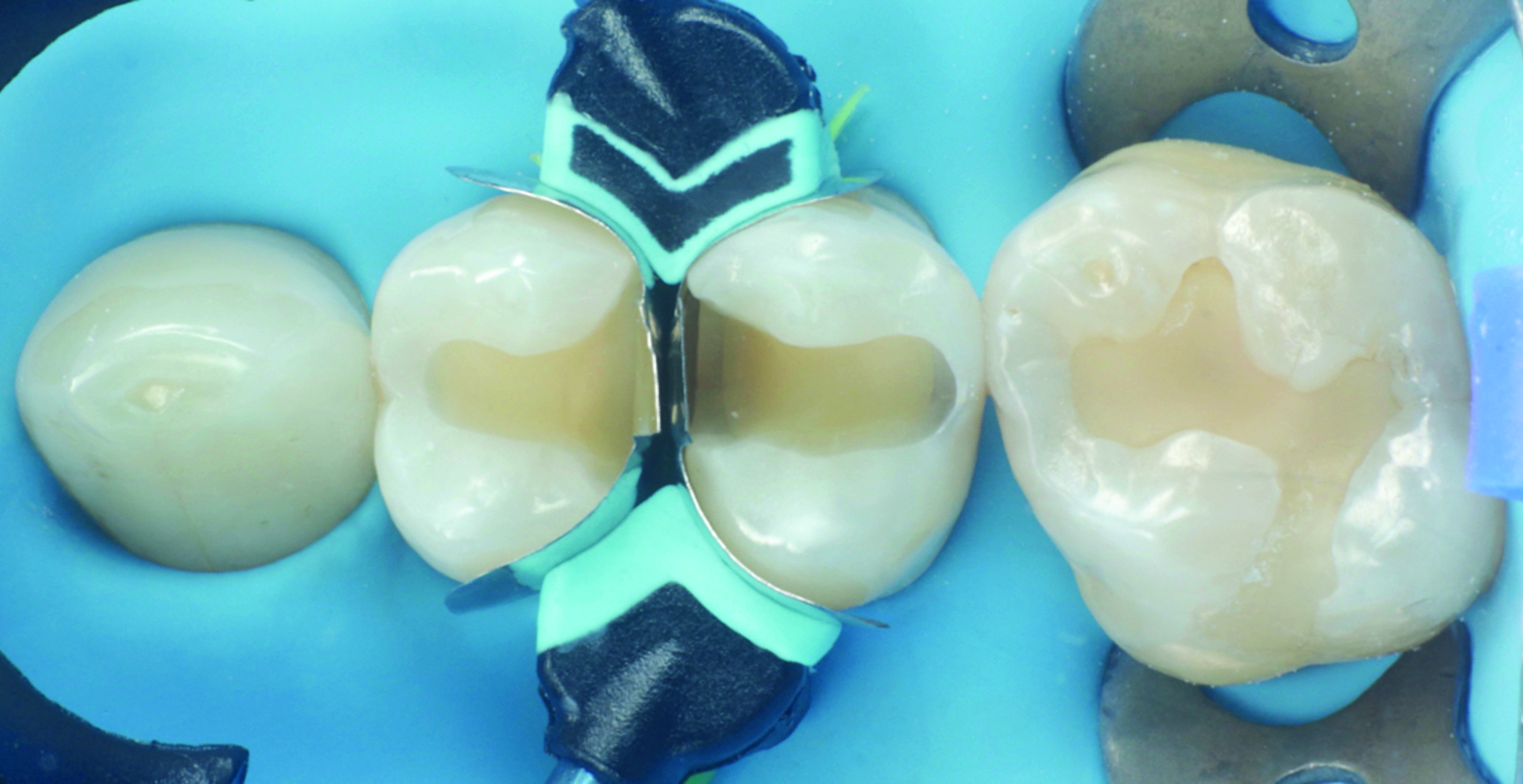 HenarejosVictor_CASE III.004_013025 Figure 4