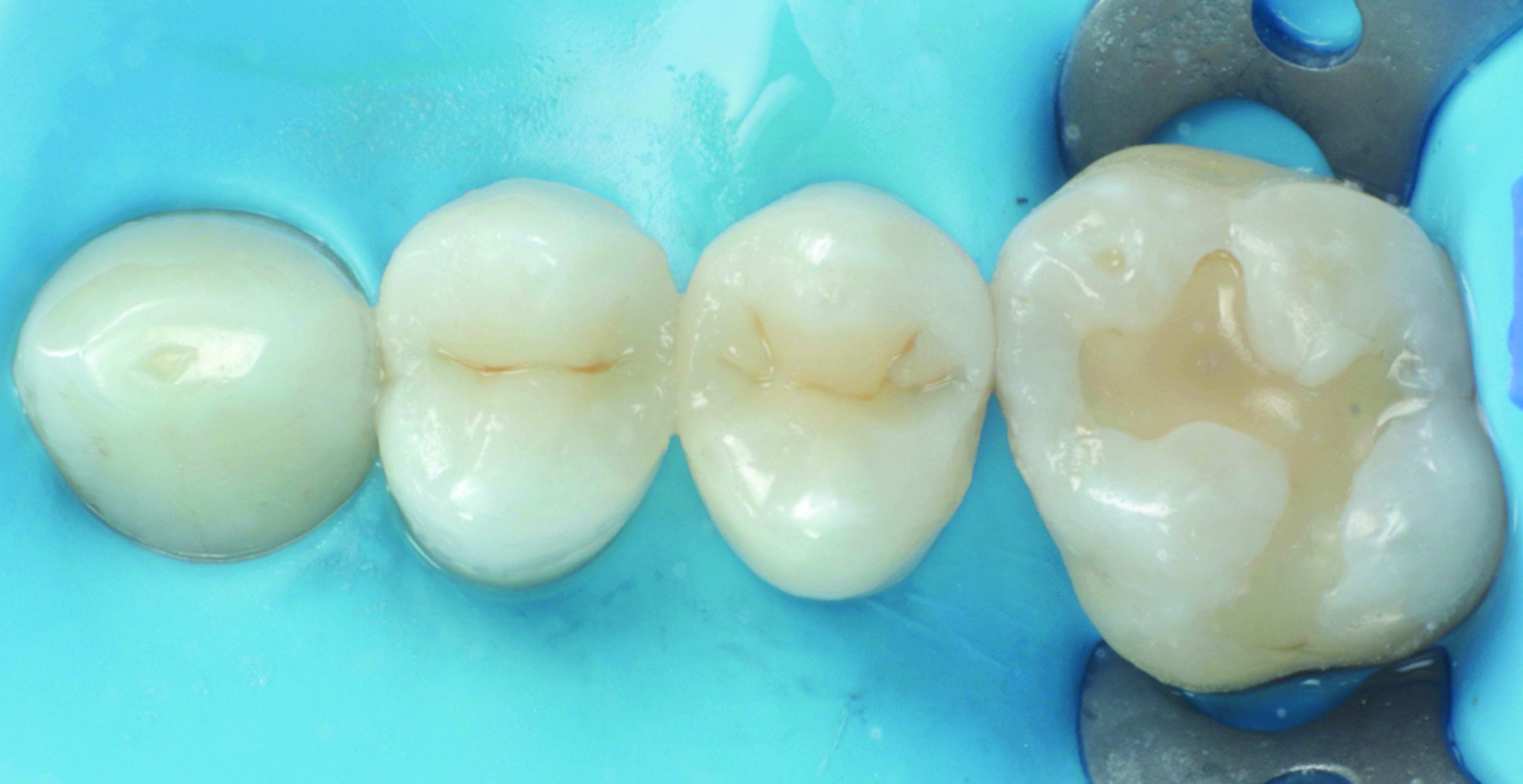 HenarejosVictor_CASE III.009_013025 Figure 9