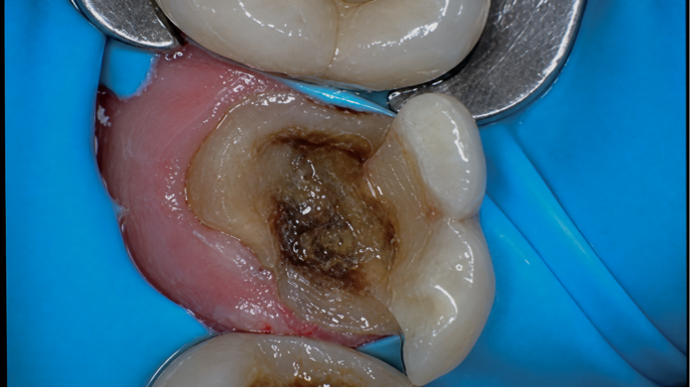Case Study Image