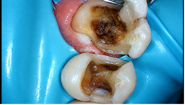 Case Study Image