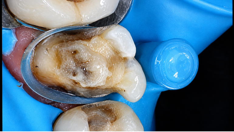 Case Study Image