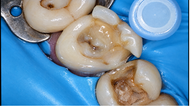Case Study Image