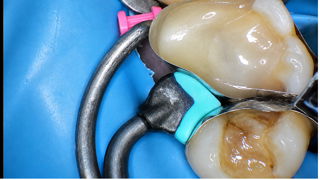 Case Study Image