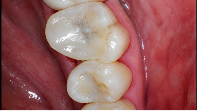 Case Study Image