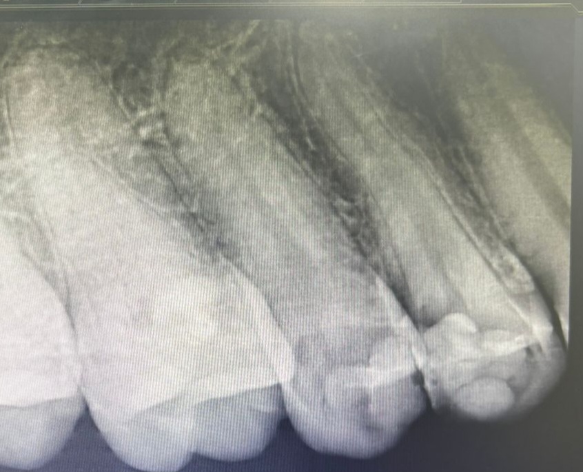 ReelMatrix case study, Dr. Maria Naranjo Radiographic Imaage