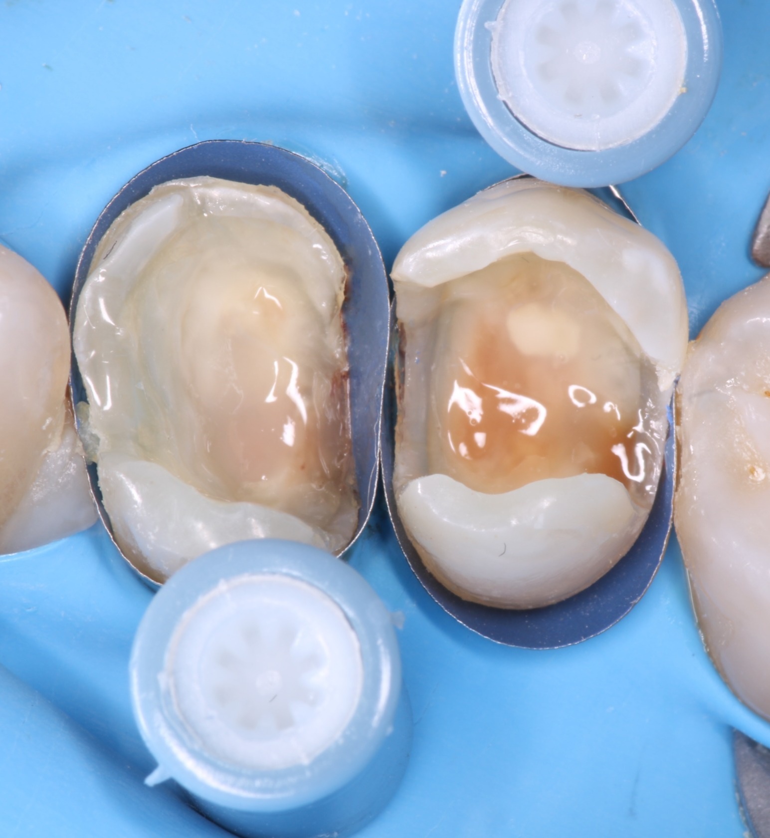 ReelMatrix case study, Dr. Maria Naranjo Image