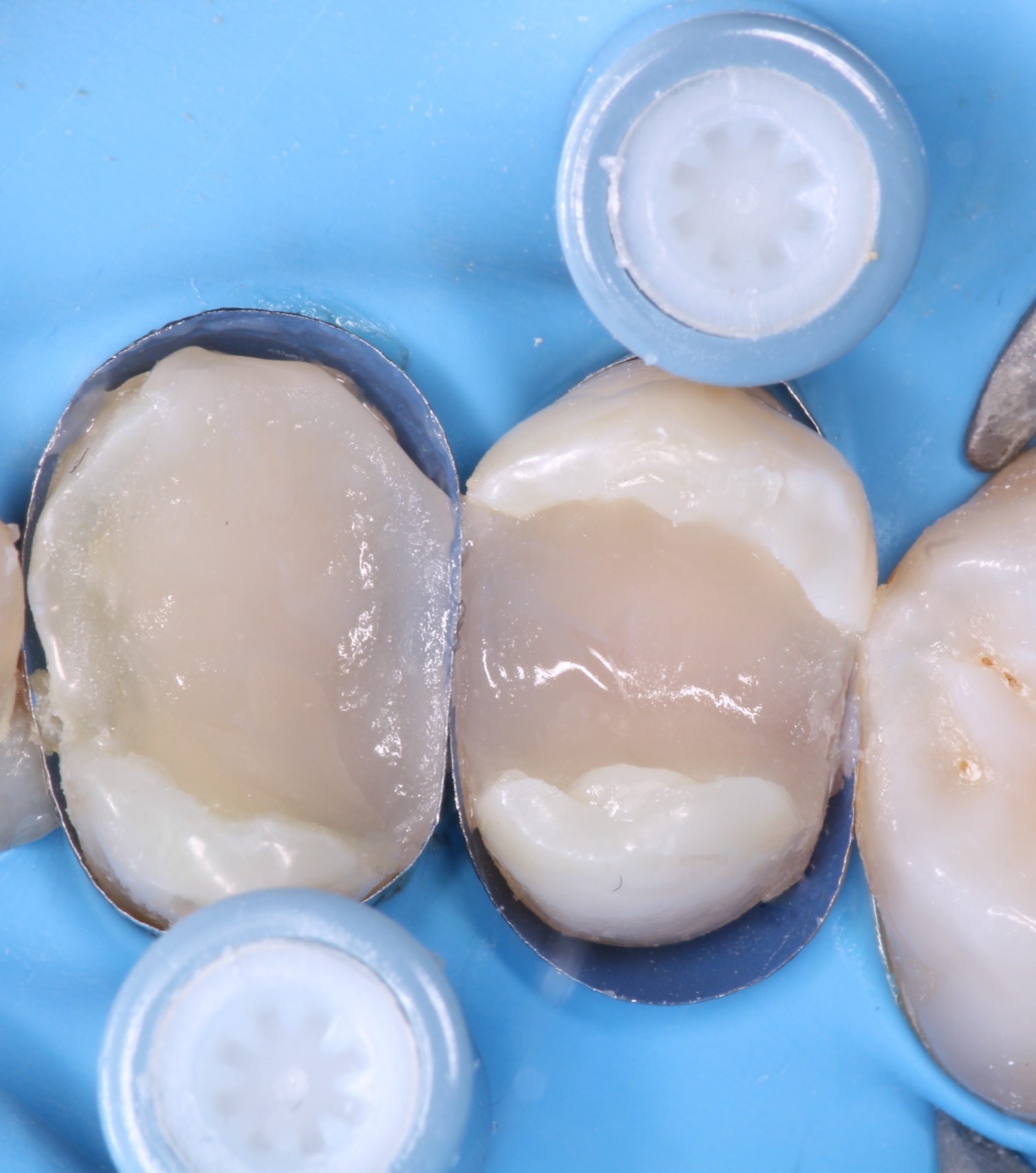 ReelMatrix case study, Dr. Maria Naranjo Image