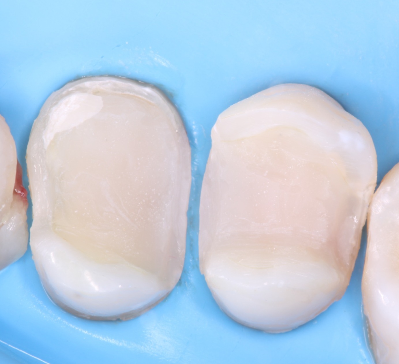 ReelMatrix case study, Dr. Maria Naranjo Image