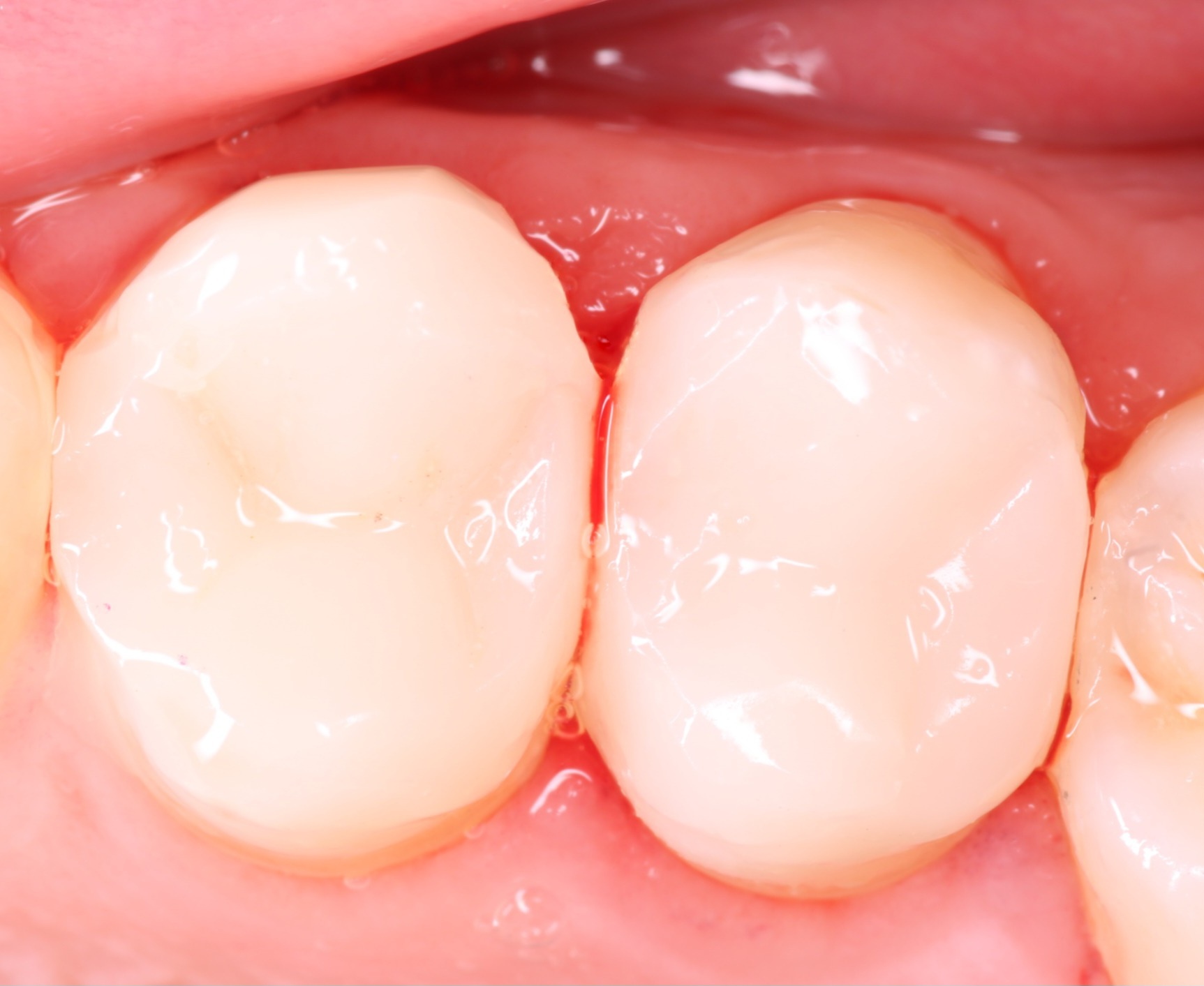 ReelMatrix case study, Dr. Maria Naranjo Image